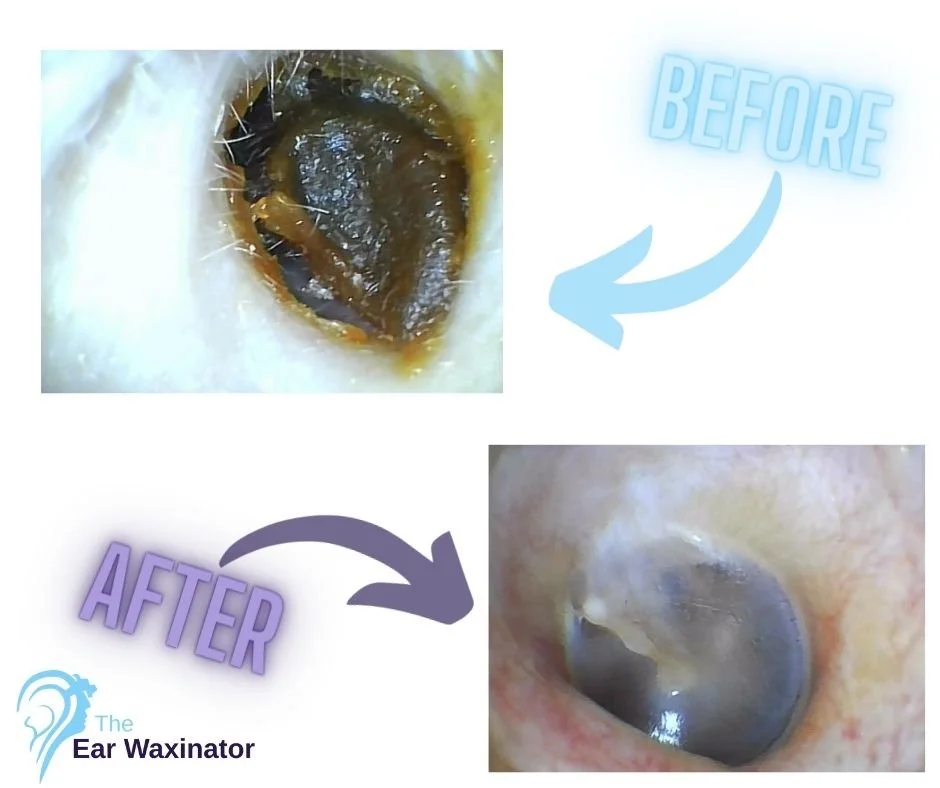Close-up images showing a before and after comparison of ear cleaning. The before image shows a dirty, wax-filled ear canal with visible wax buildup, while the after image shows a cleaned ear canal with wax removed. Text indicates 'BEFORE' and 'AFTER