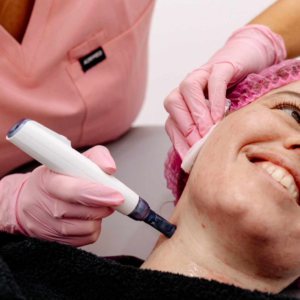 Microneedling