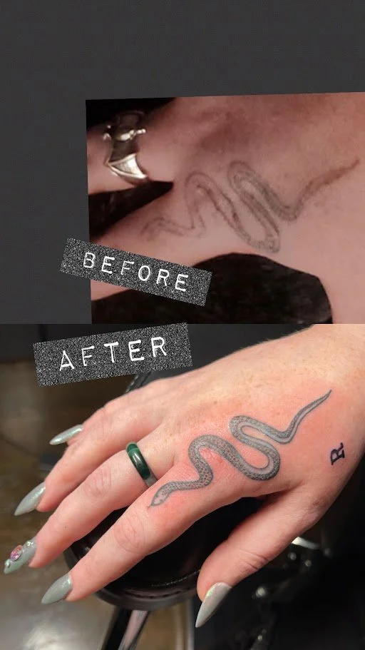 Comparison of a tattoo before and after removal, showing a snake tattoo.