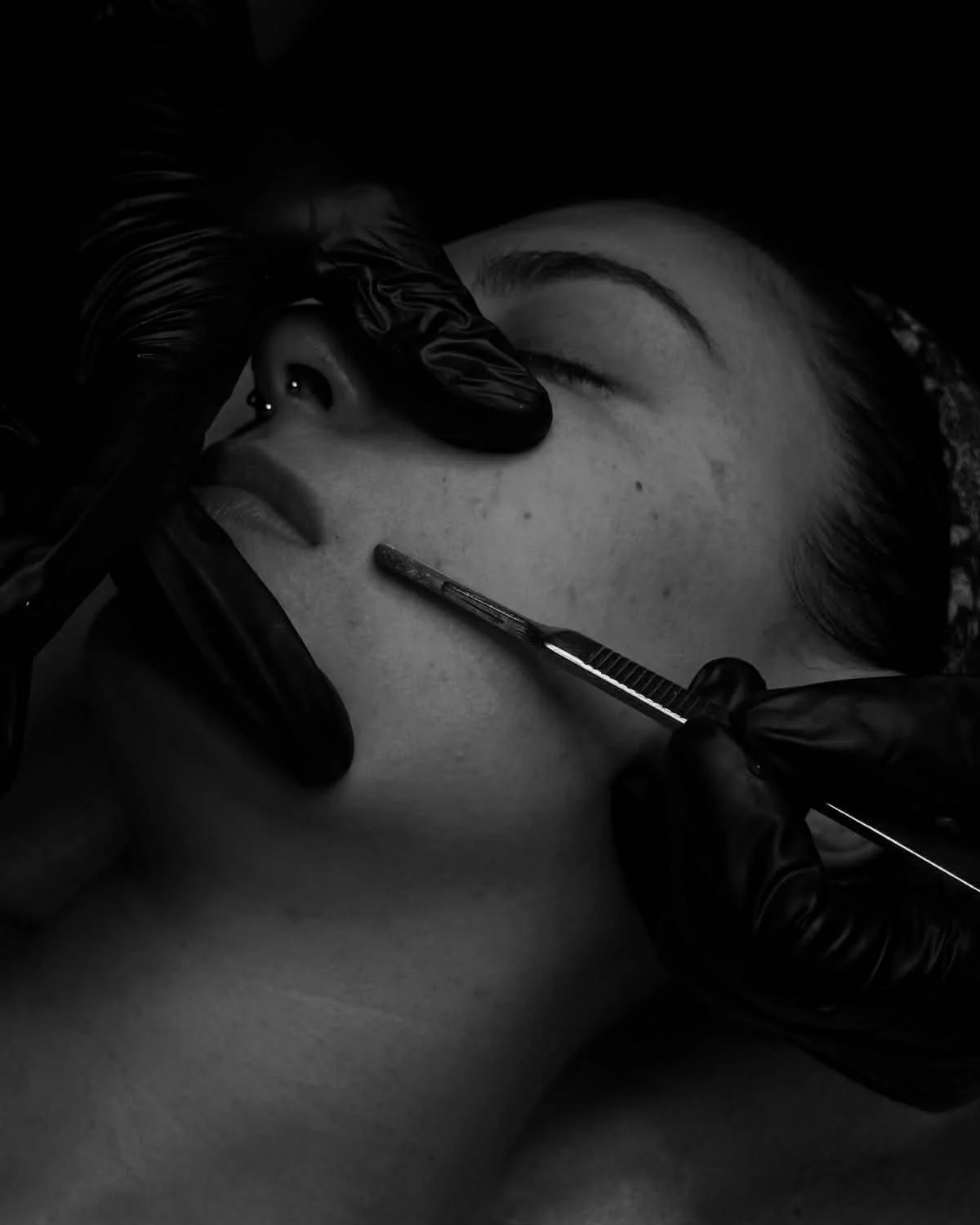 Dermaplaning Facial