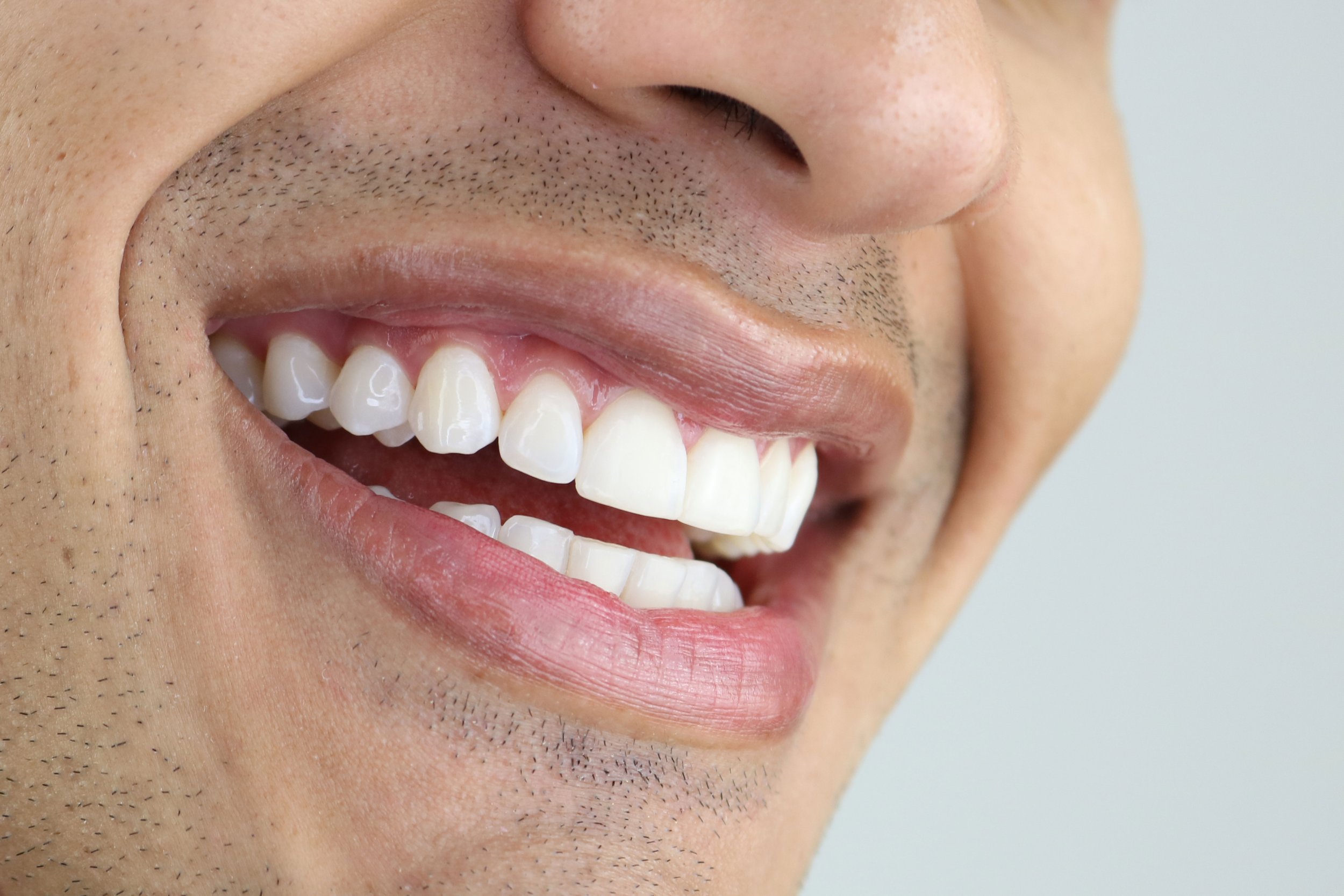 Dental Hygiene Clean & Express Whitening