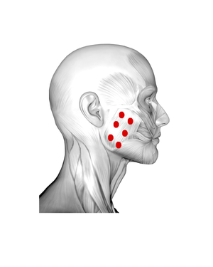 Jaw