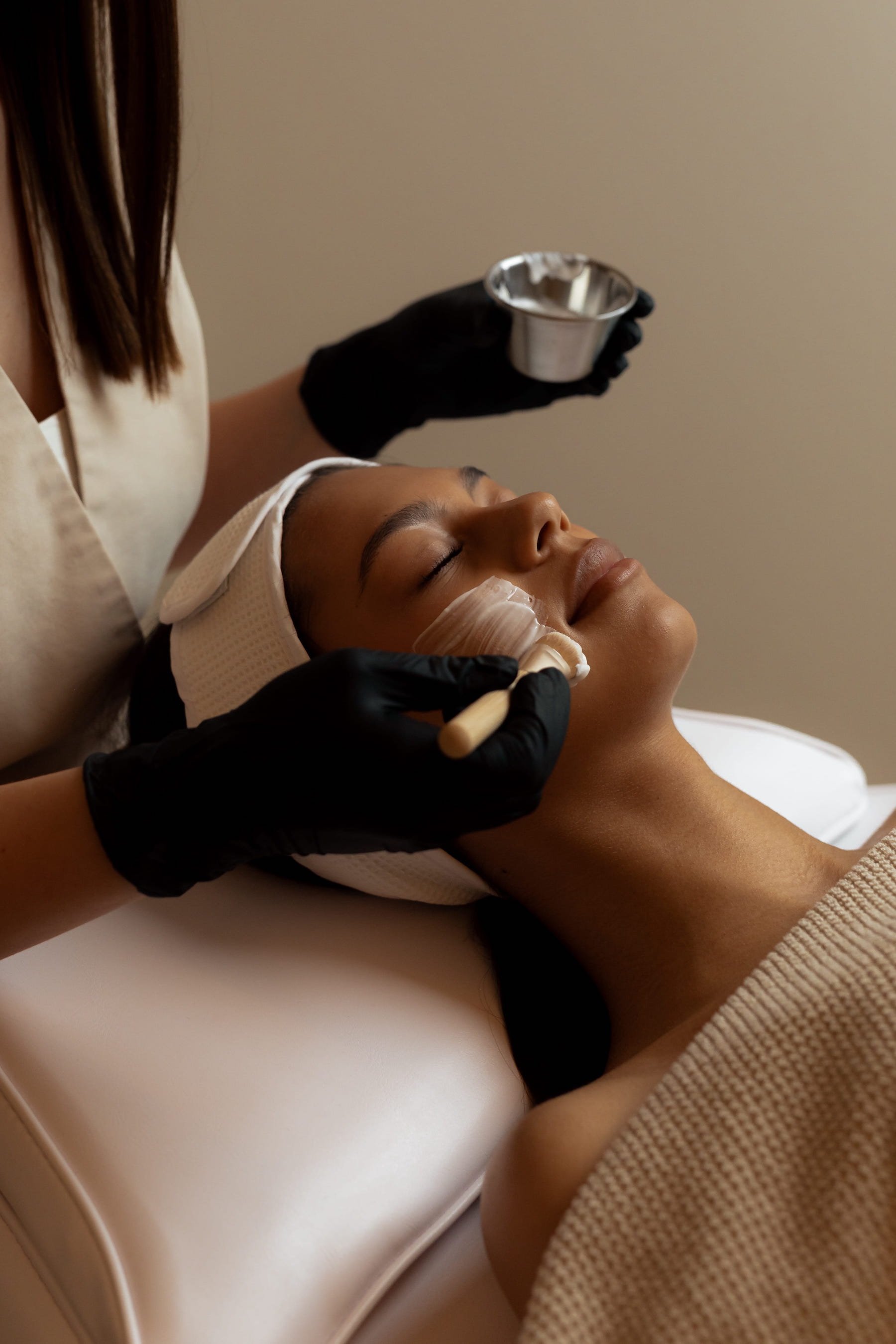 chemical peels woodland hills
