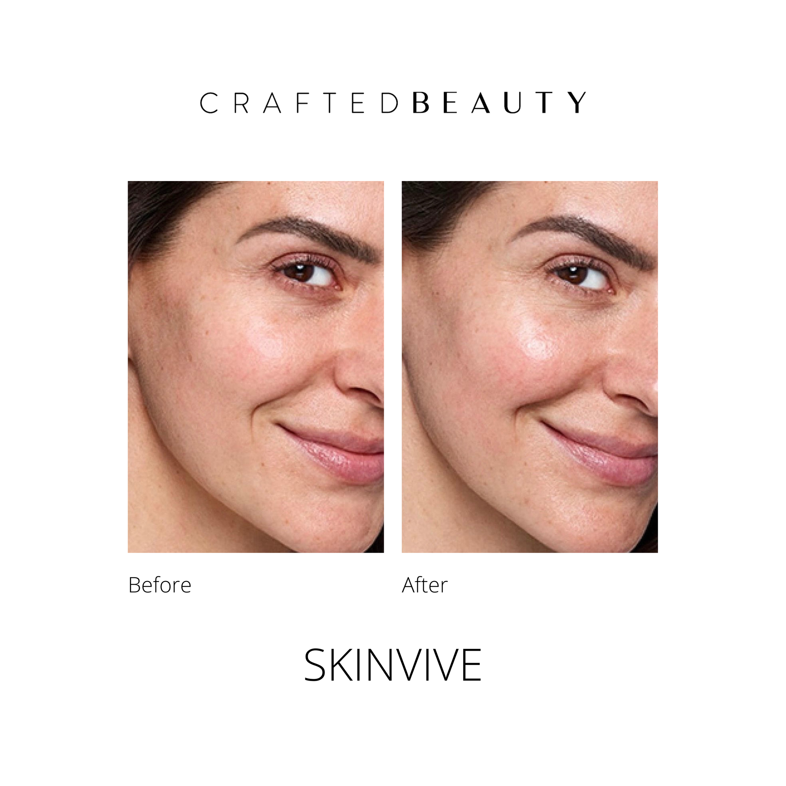 Skinvive