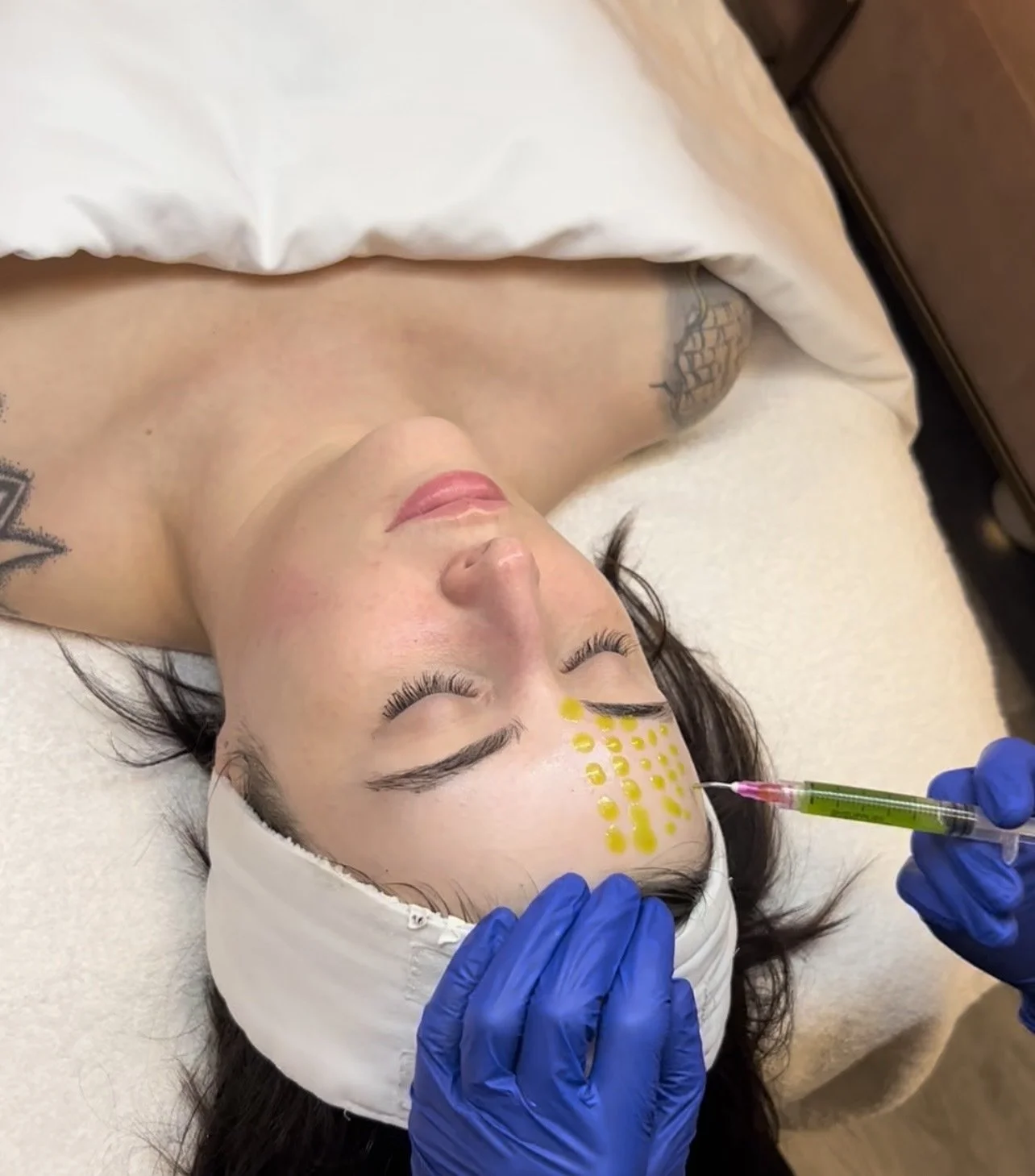 Peel treatment at Crafted Beauty Medical Spa