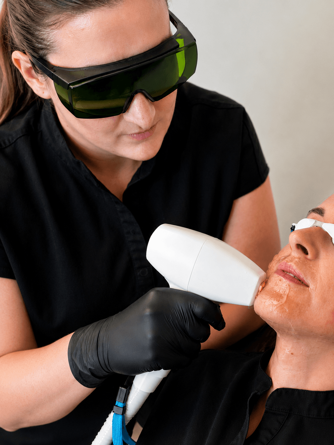 A woman wearing laser protective glasses and black gloves performs a laser skin procedure on a woman's face, who is lying down with her eyes covered.