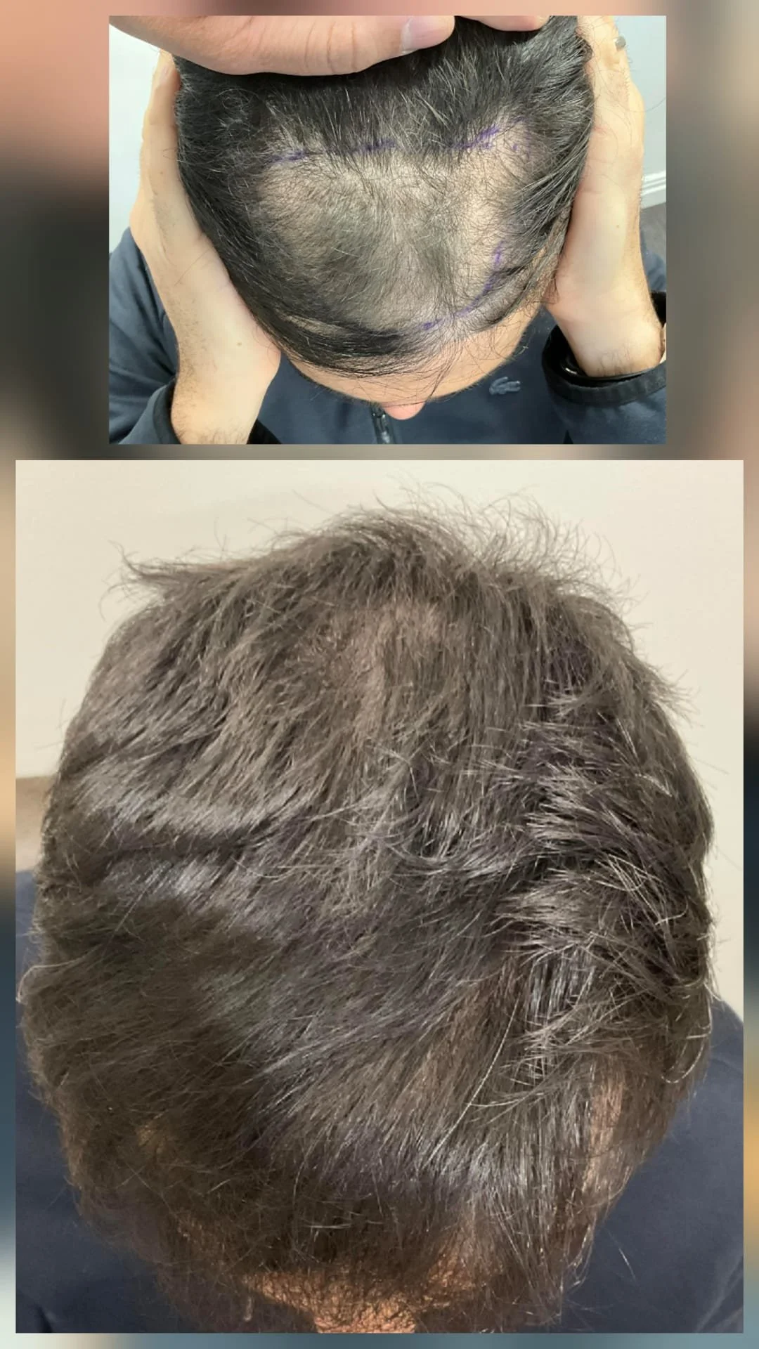Before and After 1.jpeg