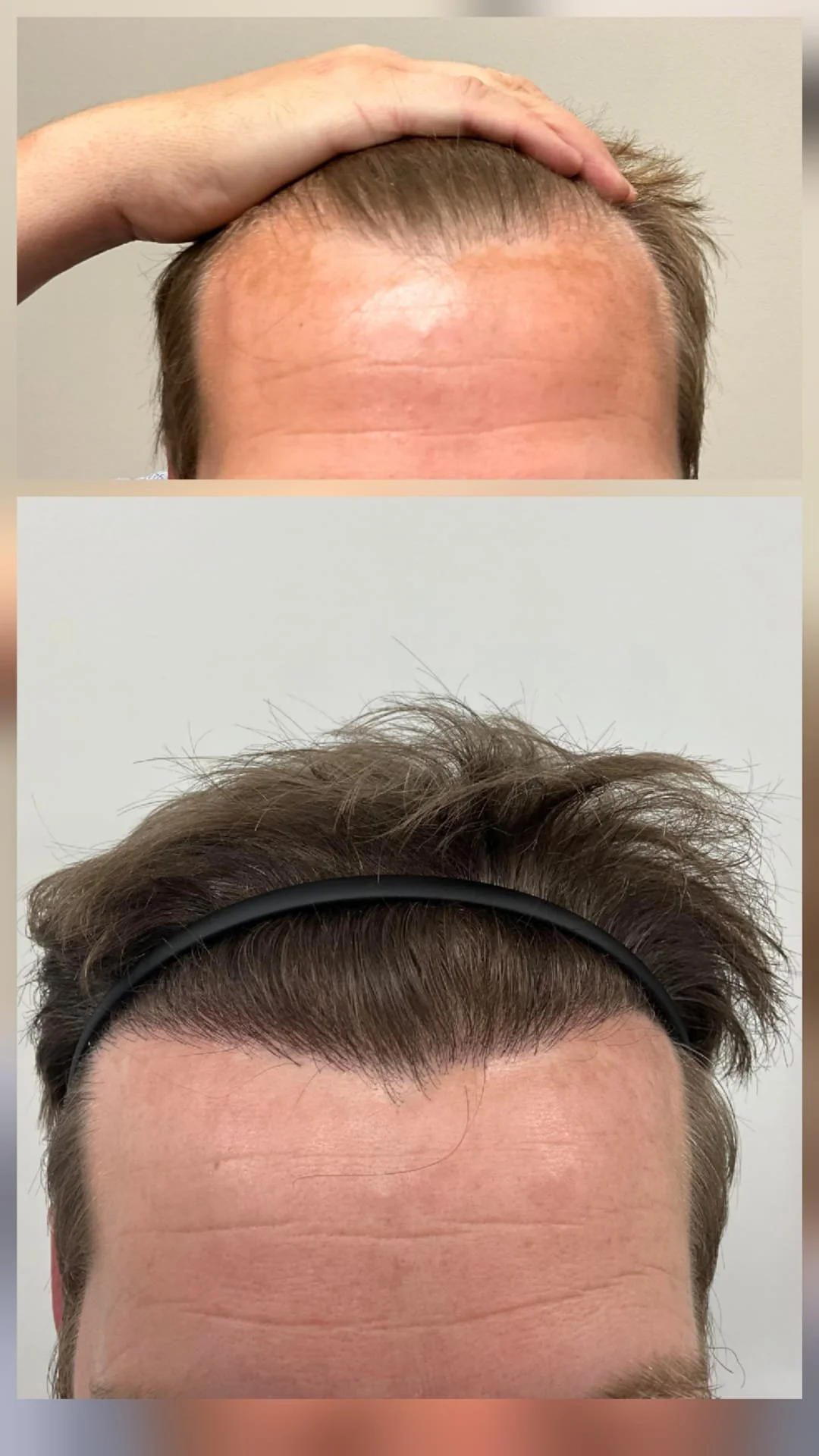 Before and After 5.jpg