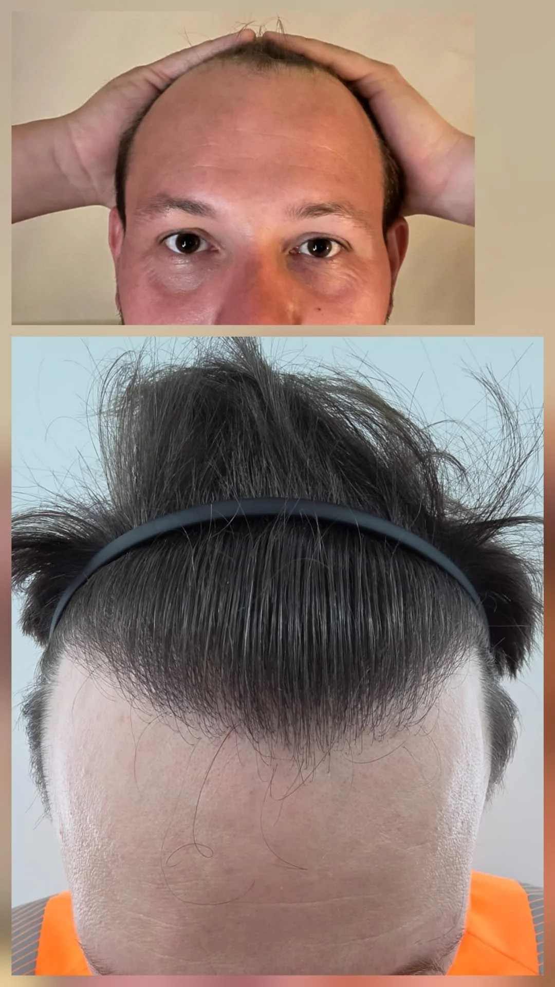 Before and After 2.jpg