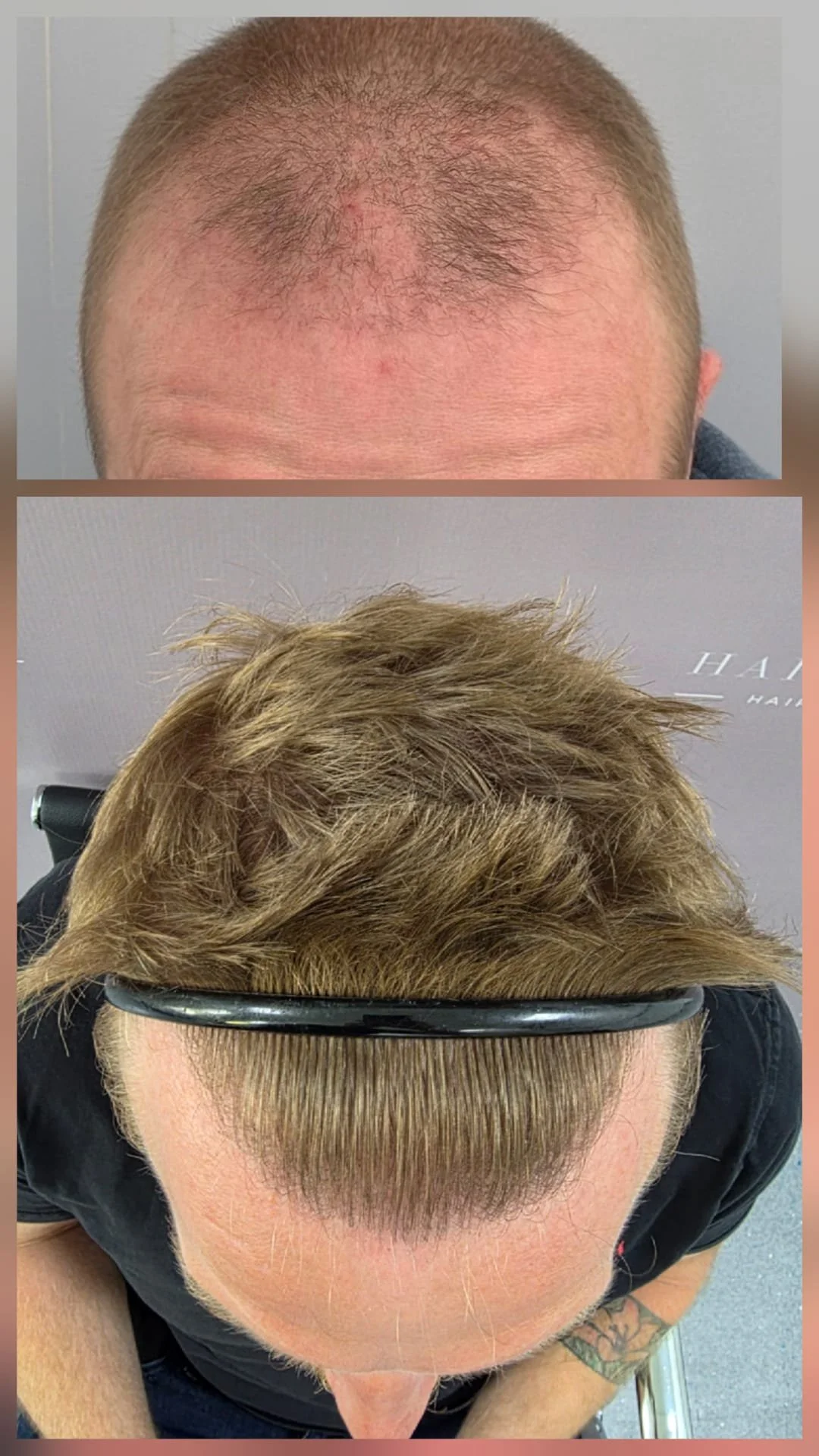 Before and After 3.jpg