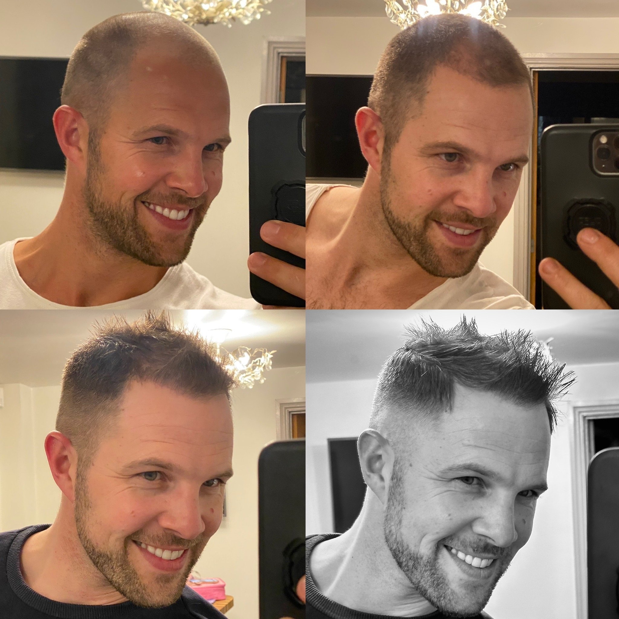 Before and After 4.jpg