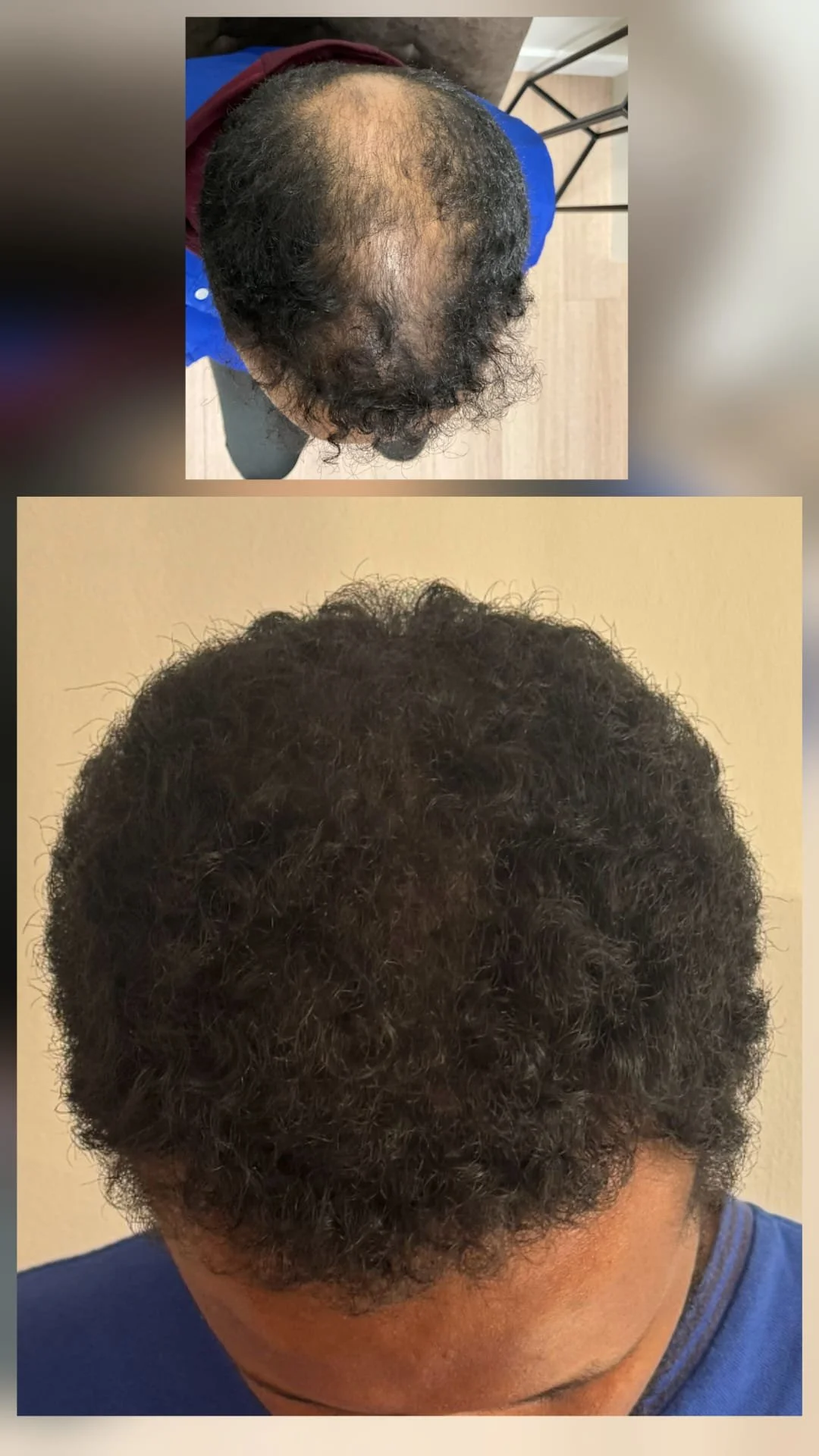 Before and After 7.jpg