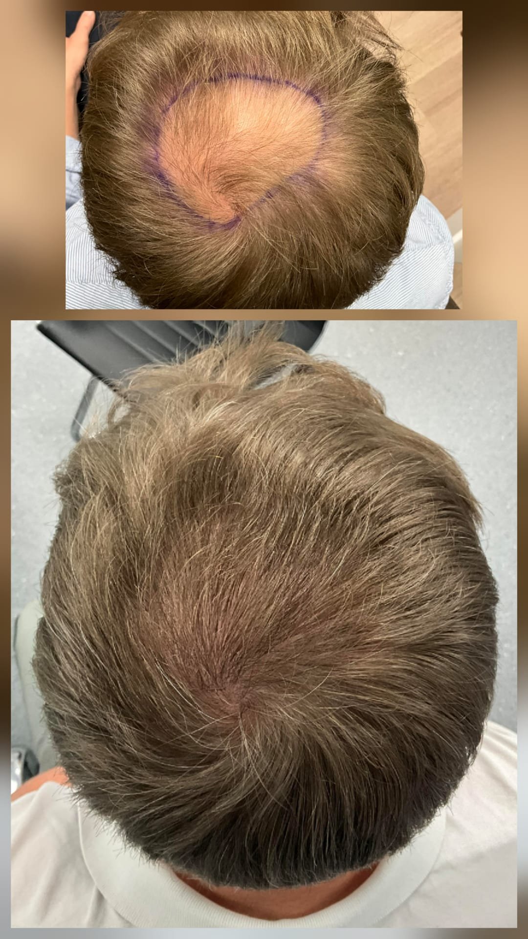 Before and After 6.jpg