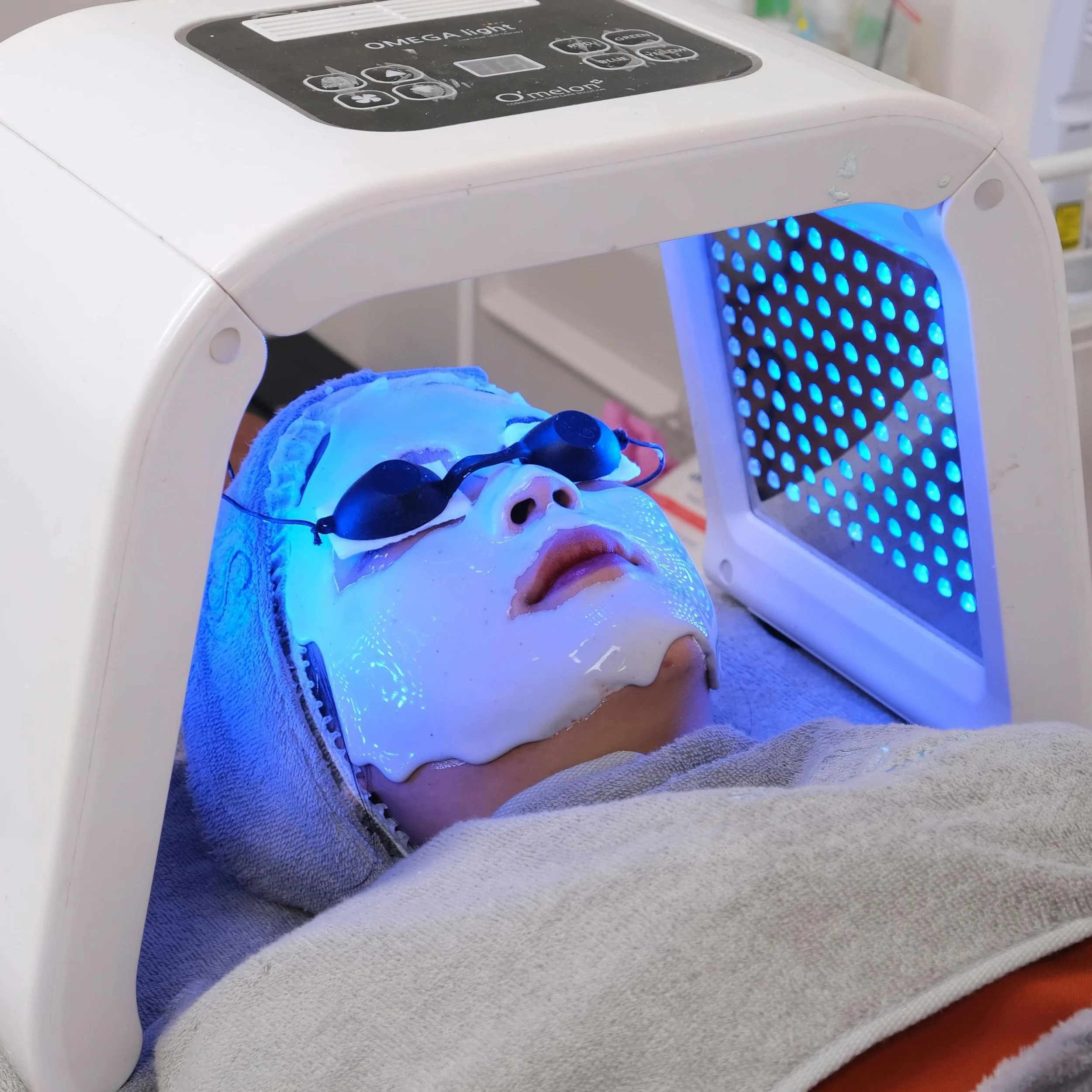 Person lying under a blue light therapy device with goggles on.