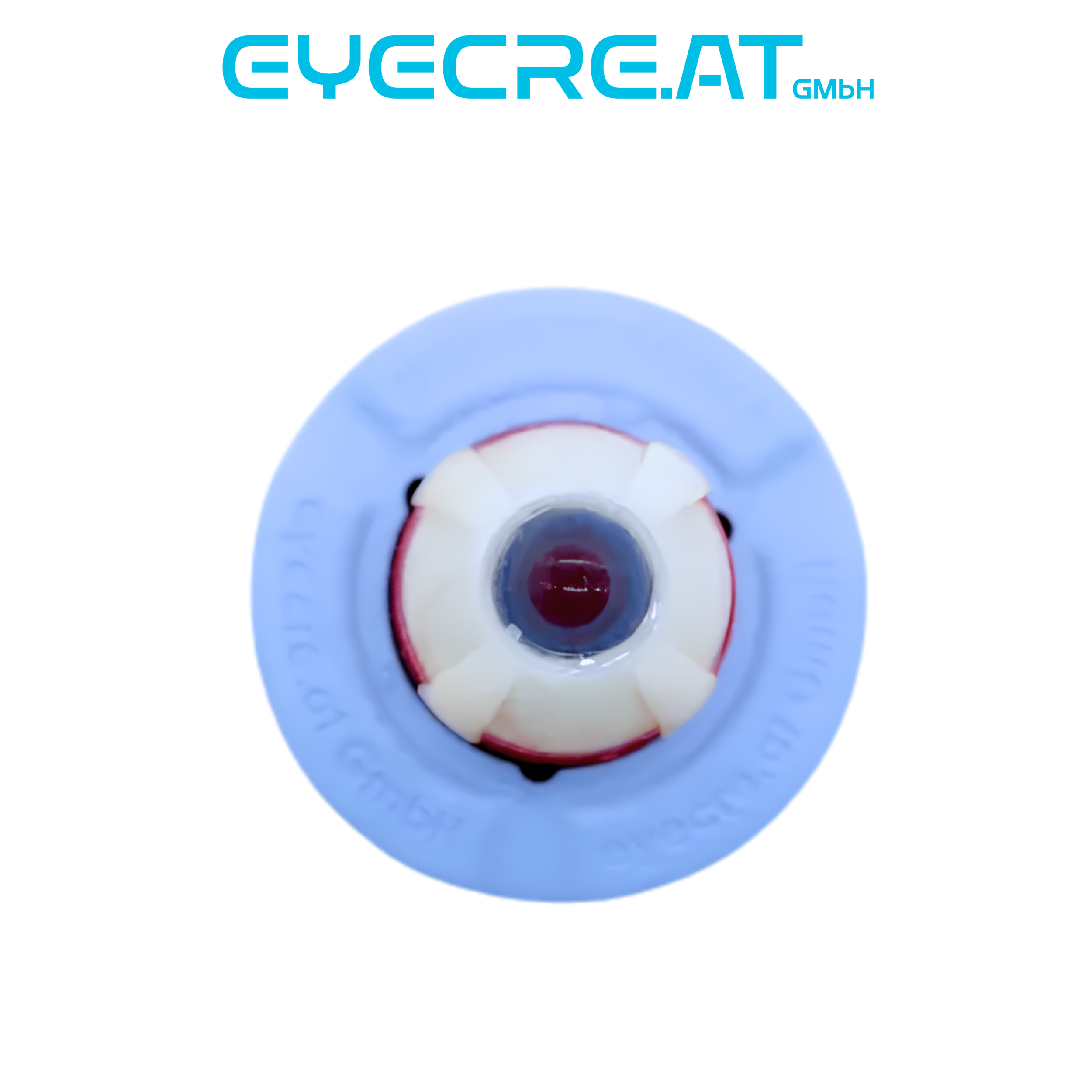 Eye 4 Strabismus and Buckling