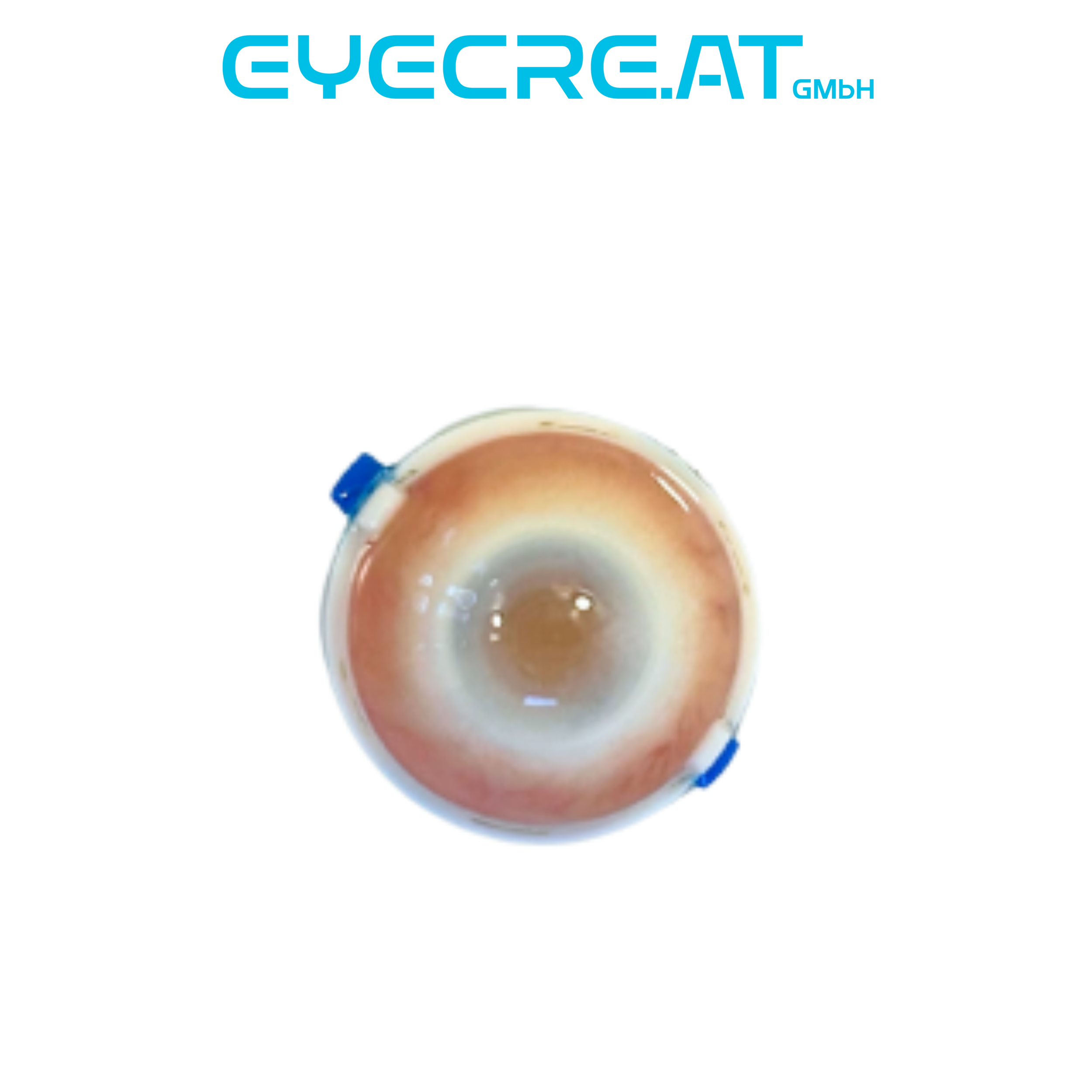 Eye 4 Trabeculectomy