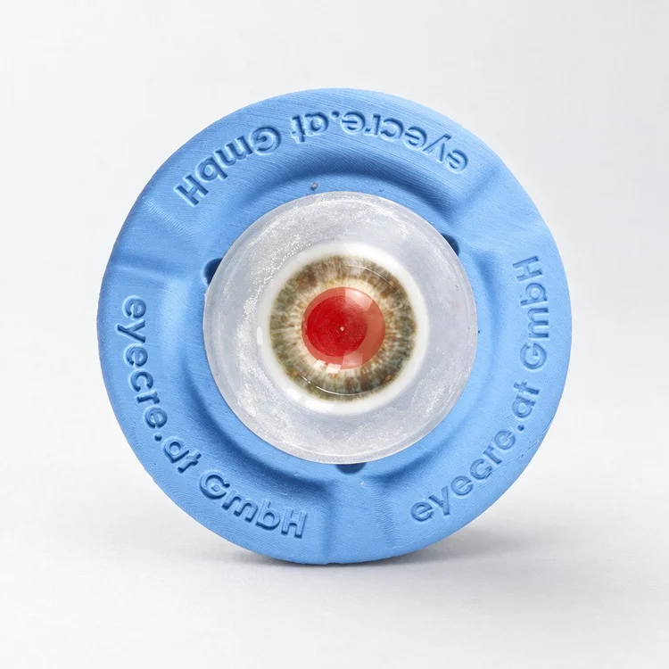 Eye 4 Aphakia