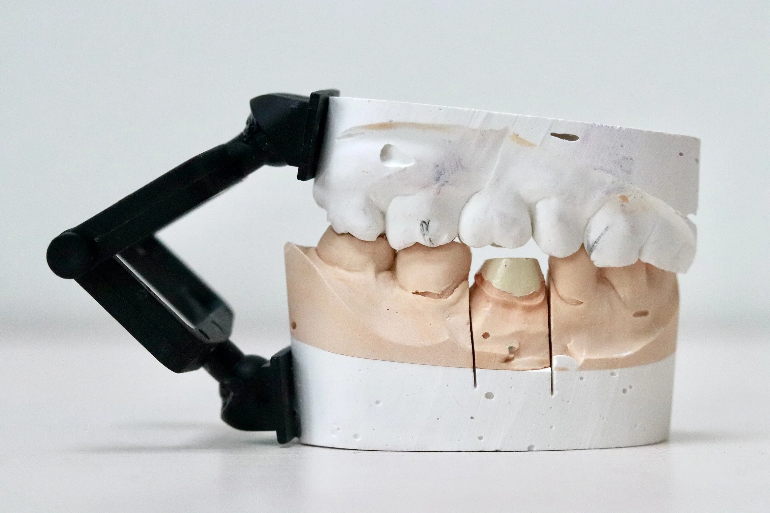 Dental Crown..JPG