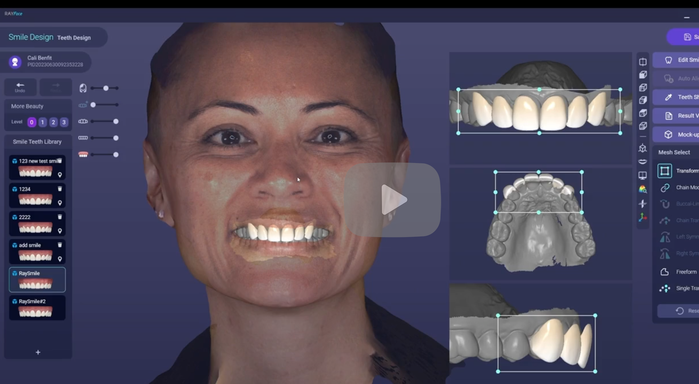 Screenshot of a dental design software showing a woman's face with digital 3D models of her teeth on the right, and a list of smile design options on the left.