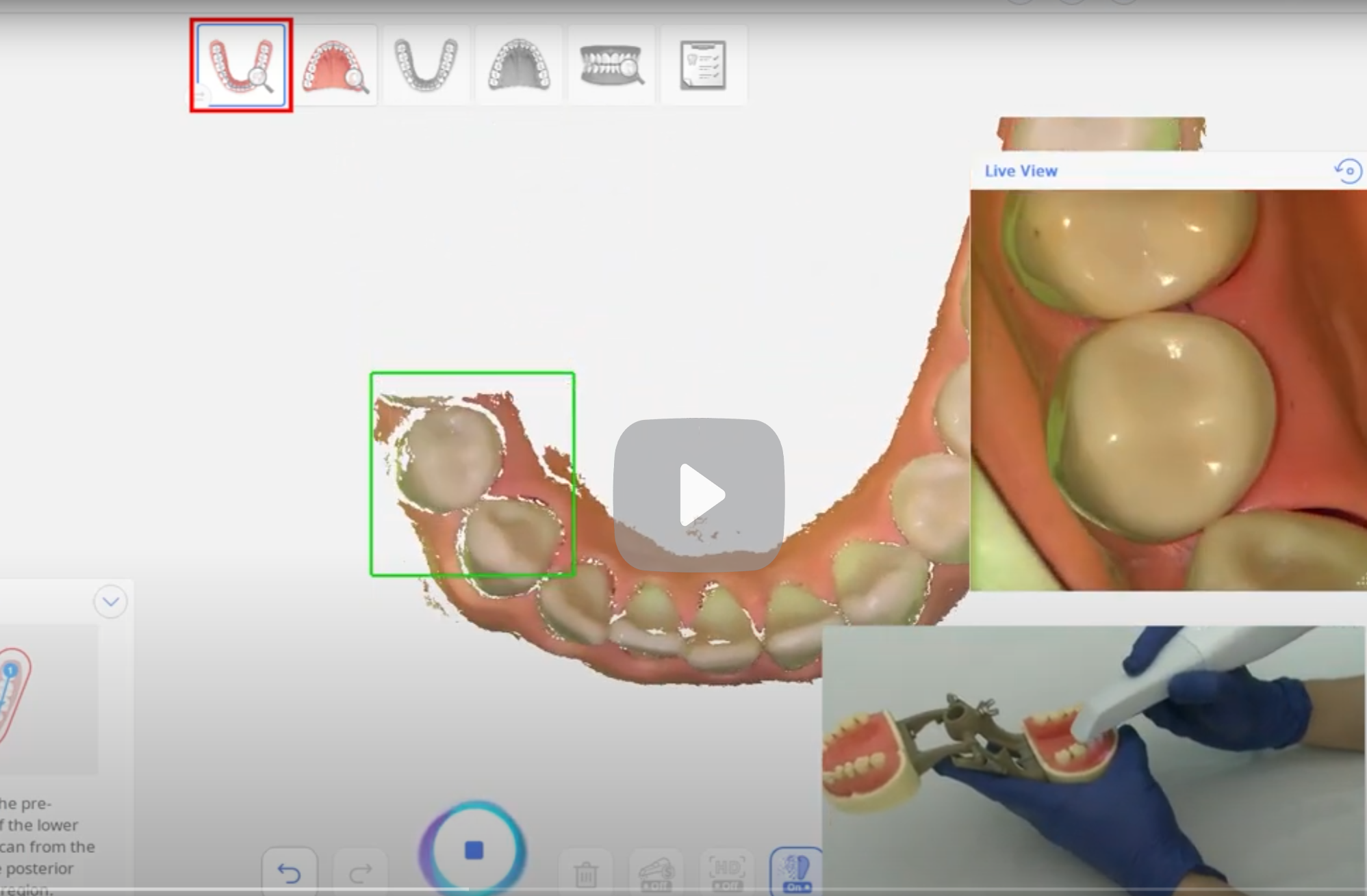 Digital illustration of a dental examination, showing an animated set of teeth and gums, a close-up of molars, and a person performing a dental procedure using a dental tool.