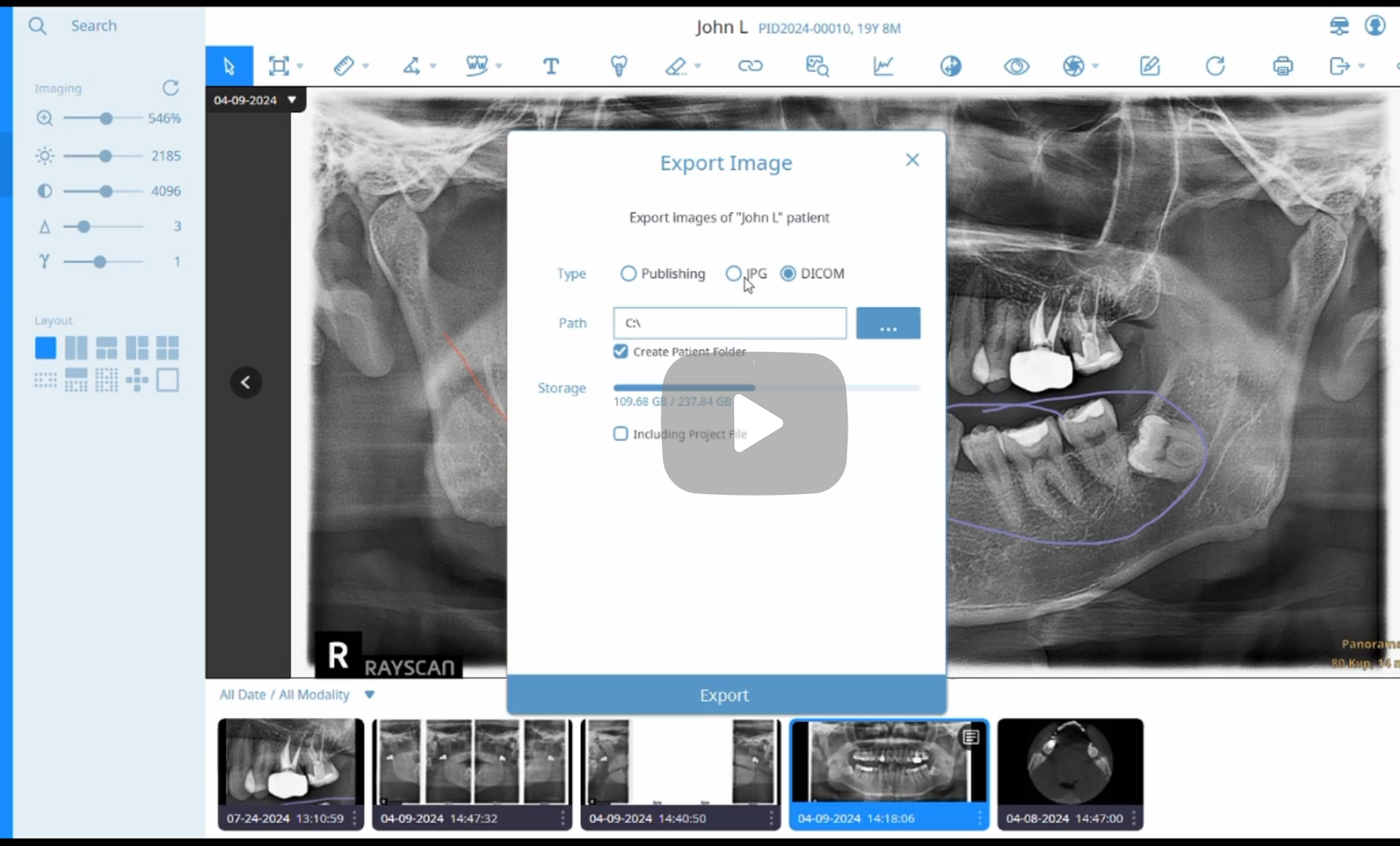 A dental X-ray displayed on a computer screen with a pop-up window for exporting the image in DICOM format, showing a panoramic view of a patient's teeth and jaw with dental work.