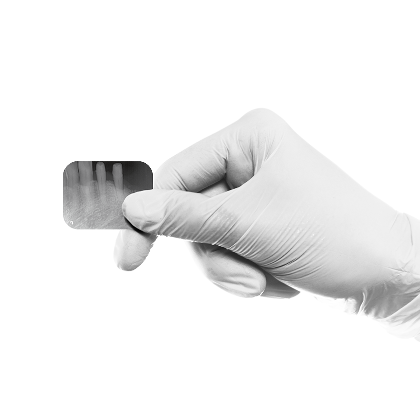 A gloved hand holding a small dental X-ray photograph of teeth.