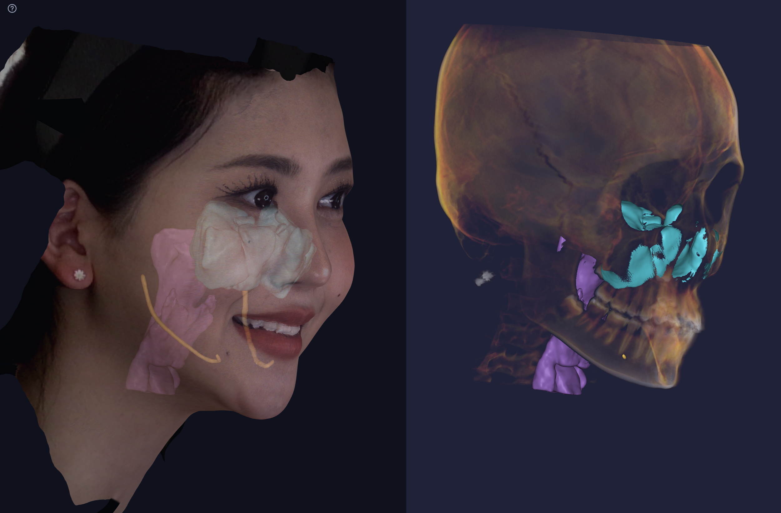 Revolutionizing Sleep Medicine in Dentistry The Advantages of Large FOV CBCT Technology