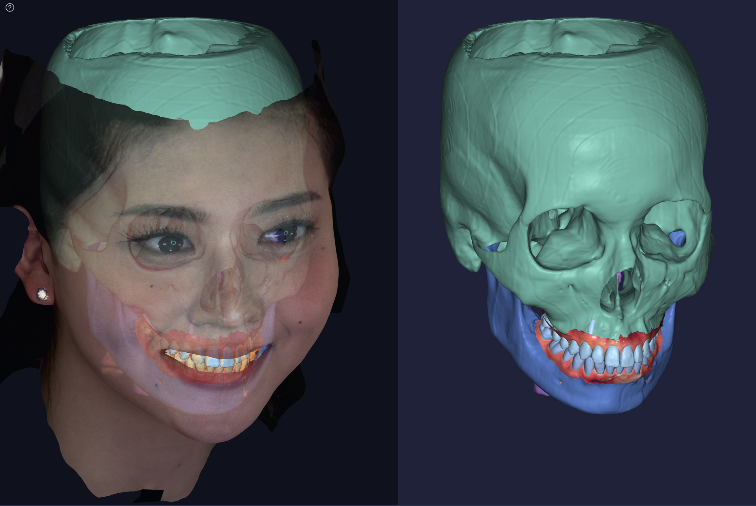 Advantages of Large FOV CBCT in Orthodontics