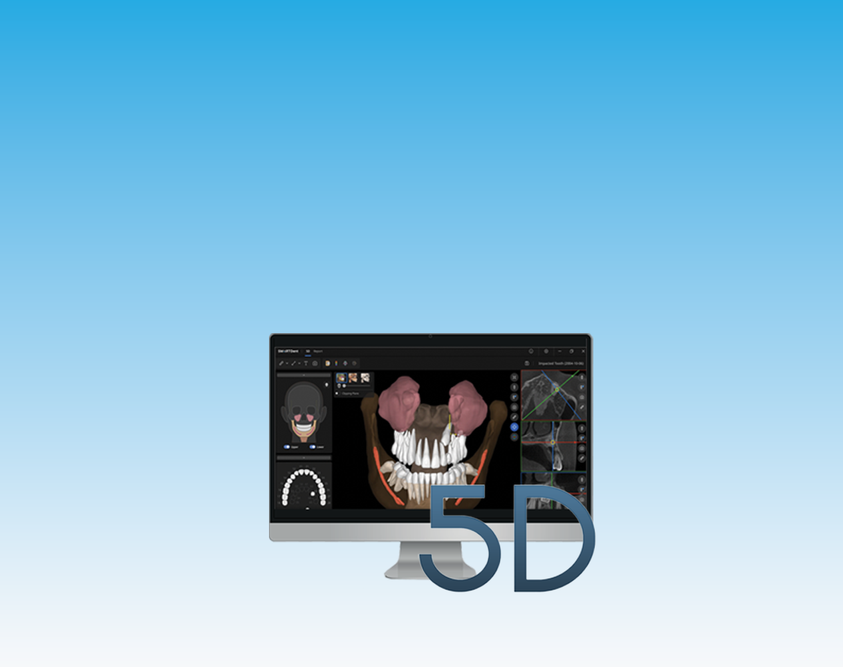 A computer monitor displaying 3D dental imaging software with a 3D model of a human skull and teeth, surrounded by various user interface elements, with large text "5D" in front.