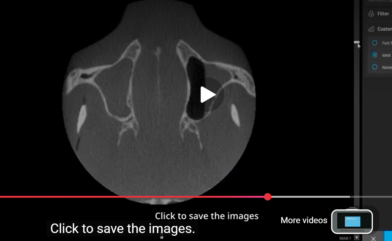 Screenshot of dental imaging software displaying X-ray images of a patient's skull and teeth, with the software name RealGUIDE Software visible.