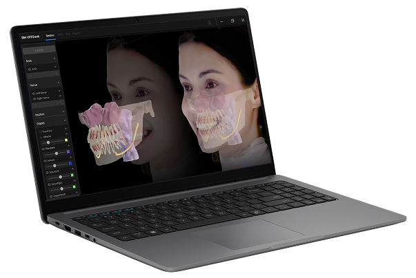 A laptop displaying a 3D dental scan of a woman's teeth and jaw on its screen, with her face reflected in the display.