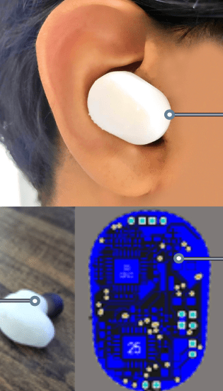 Close-up of a person's ear with a white hearing aid, bottom left shows the hearing aid outside the ear on a surface, bottom right shows a circuit board, indicating the electronic components of the hearing aid.