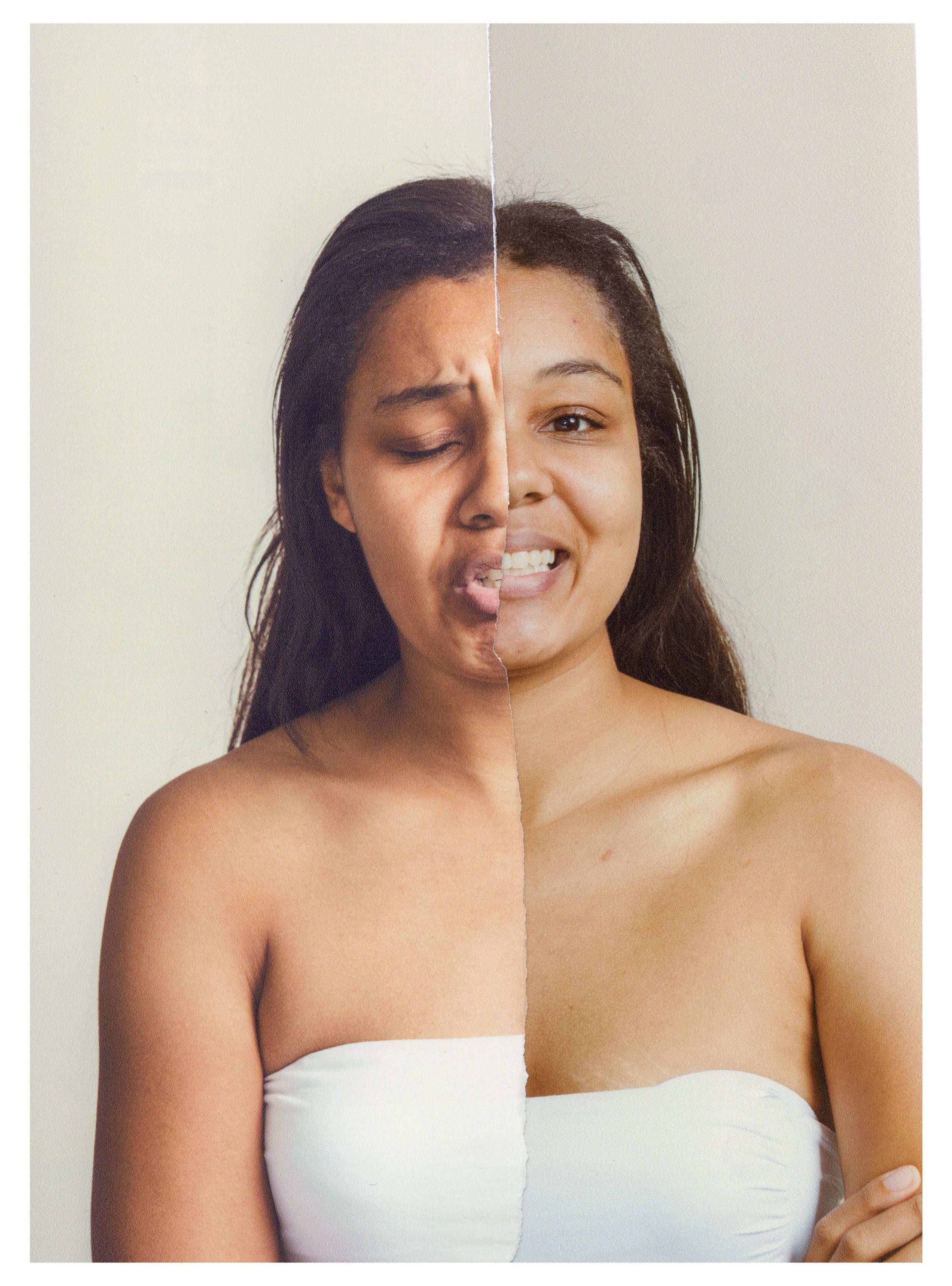 A side-by-side comparison of a woman, with her left side showing signs of skin issues with red patches and her right side appearing clear and healthy.