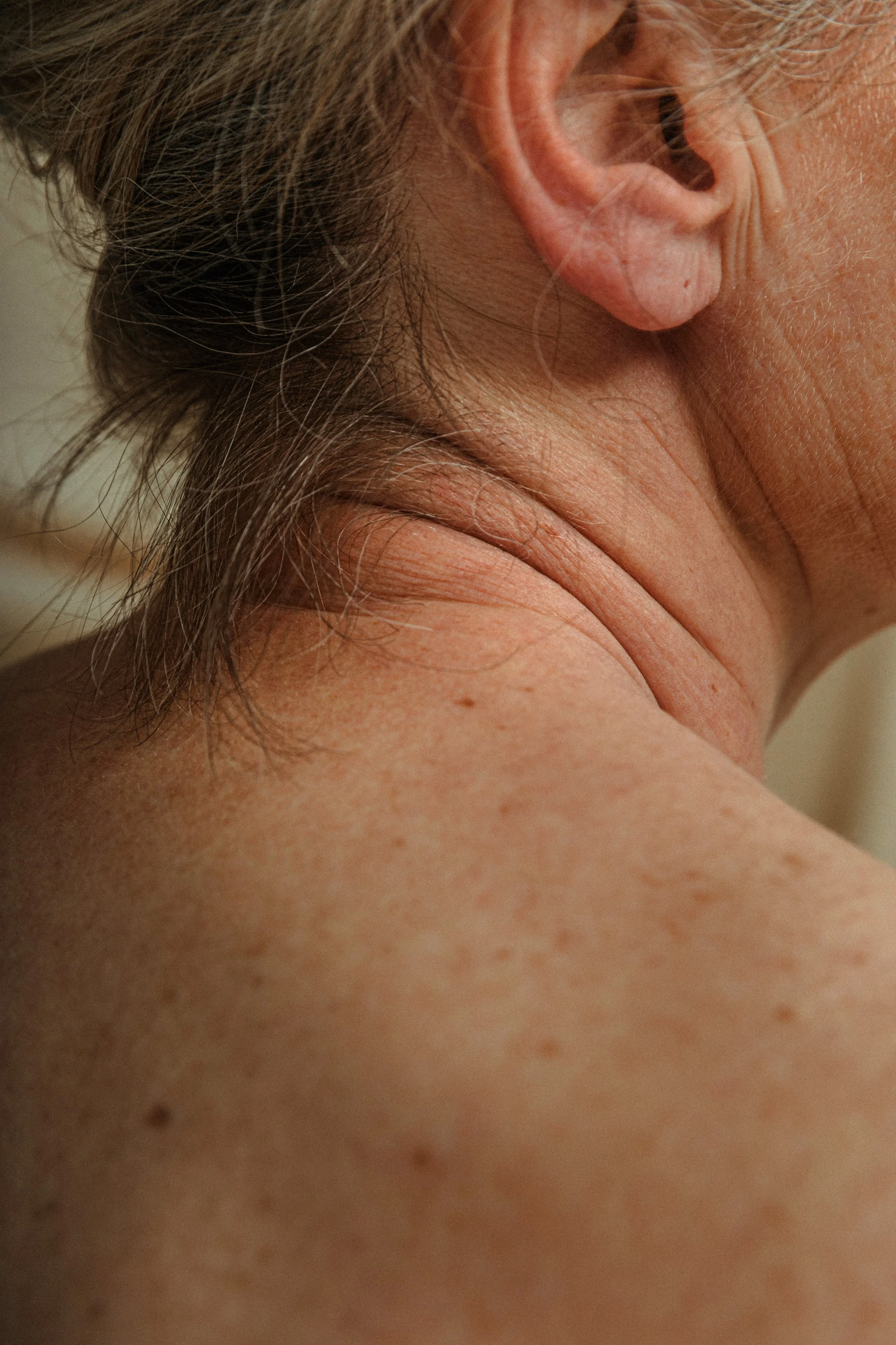 CAC23570CamdenSKINIMAGESA2.JPG