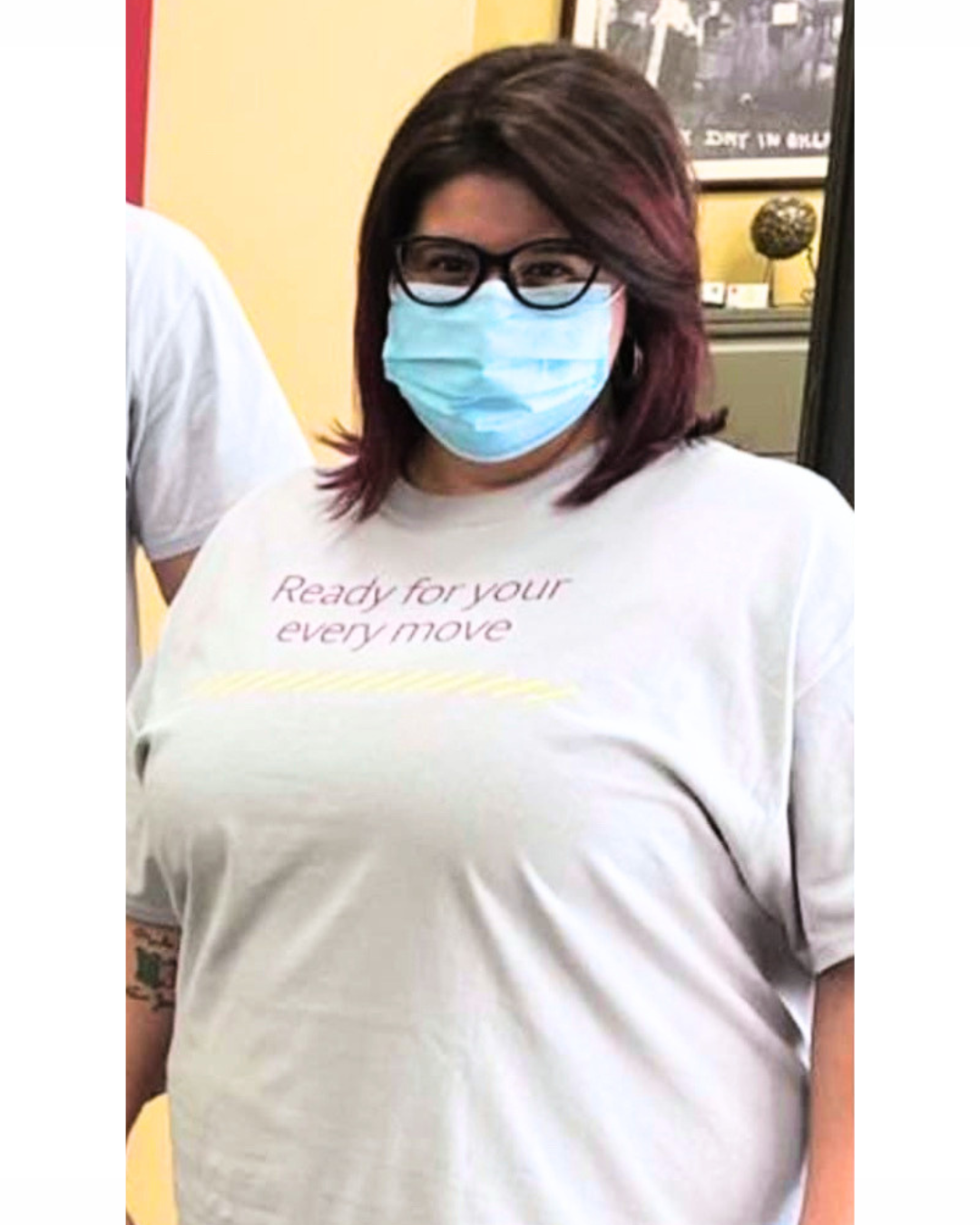 Before photo of patient 3