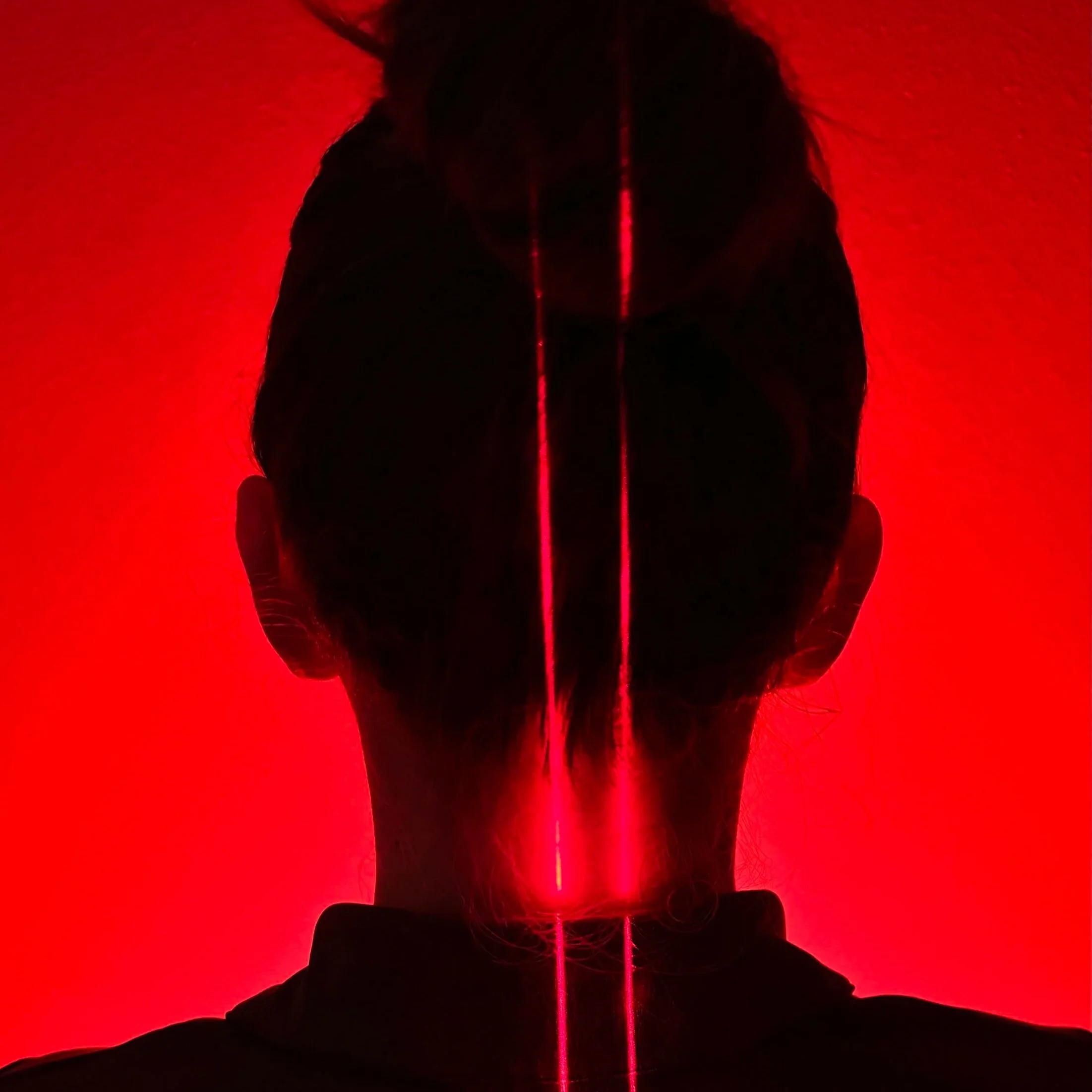 Erchonia XLR8 Laser at ICE