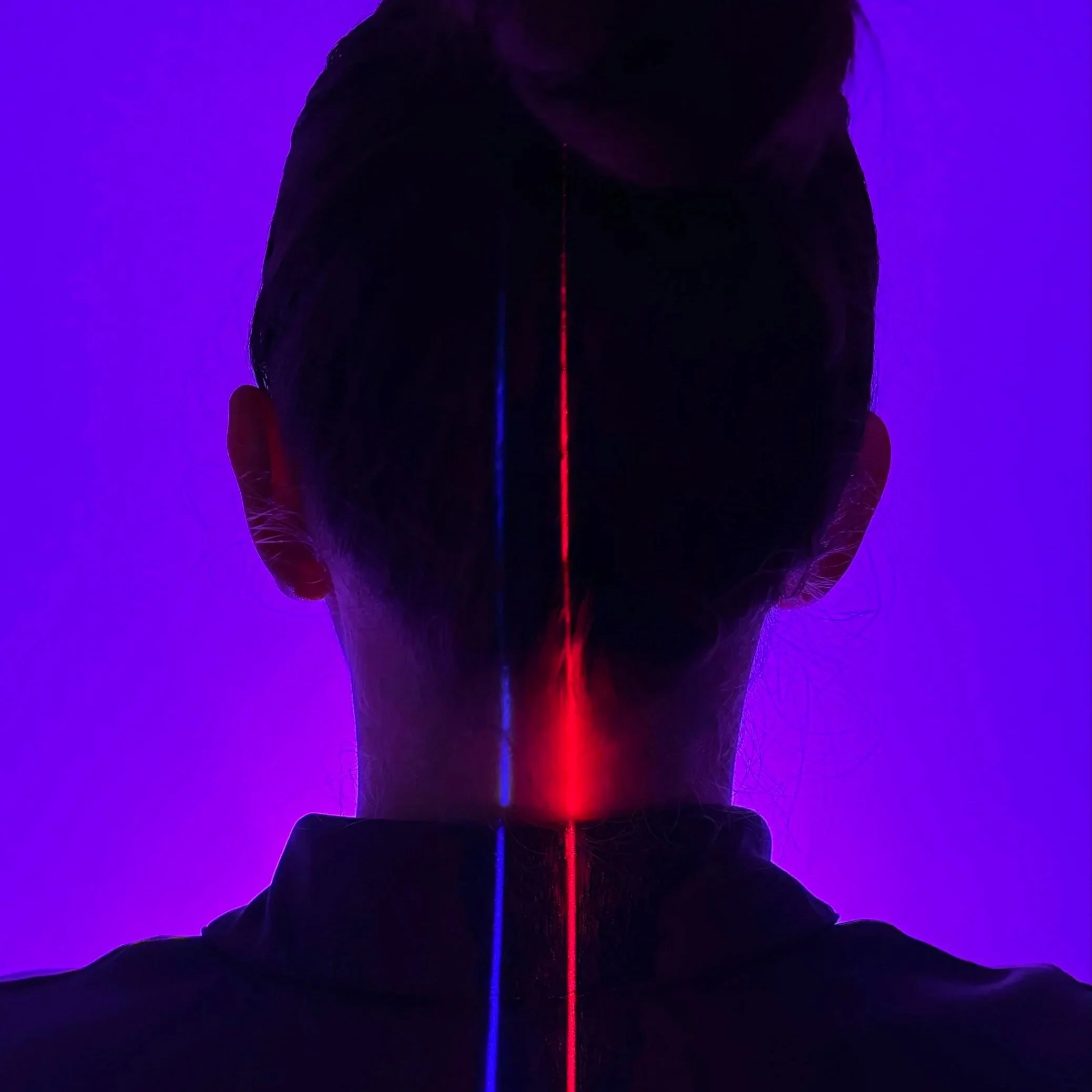 Erchonia EVRL Laser at ICE