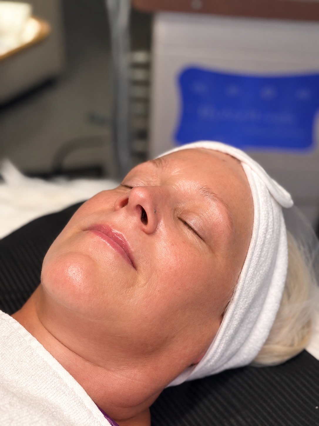 Hydrafacial Gesichtsbehandlung bei Luna Beauty in Bergdietikon