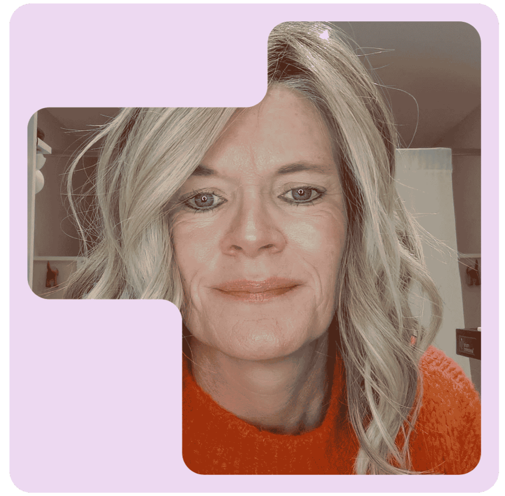 Alternative Hair Consultation providing supportive guidance for clients experiencing hair loss or thinning hair.