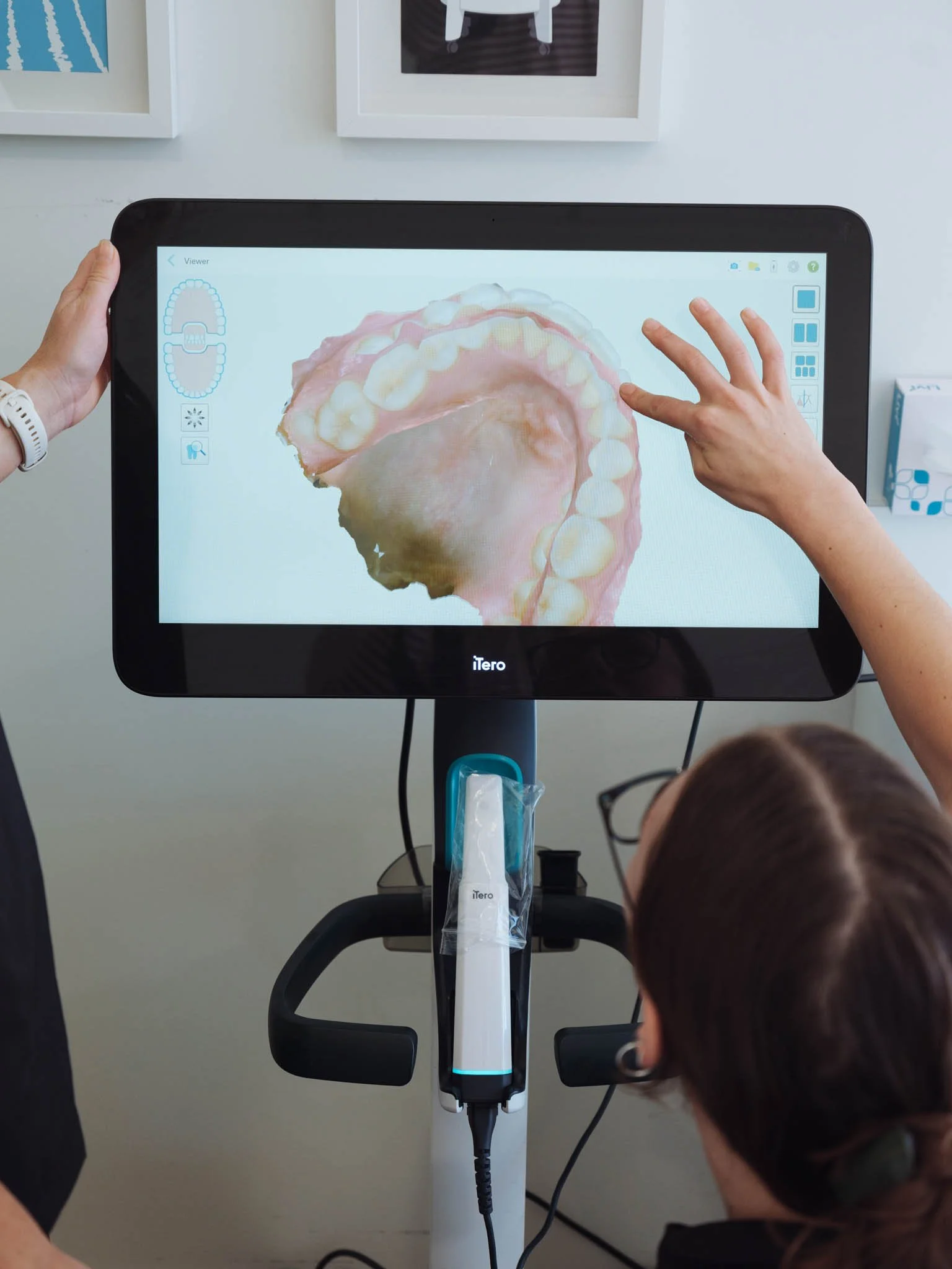 Staff assessing a 3D scan of a patient's teeth