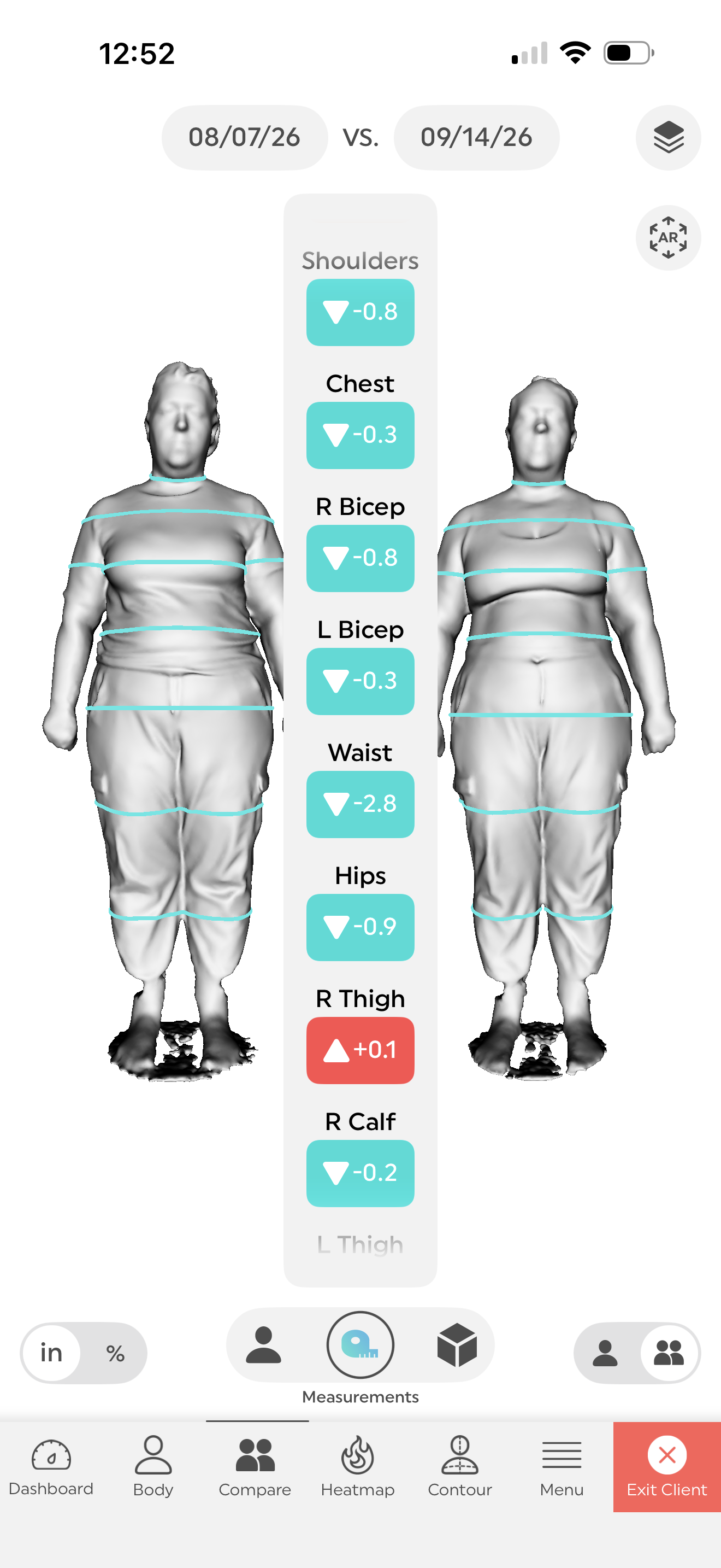 In just a few weeks, the client saw almost 3 inches dropped with laser alone. No diet changes, light to moderate exercise throughout the week and sculpting sessions. 
