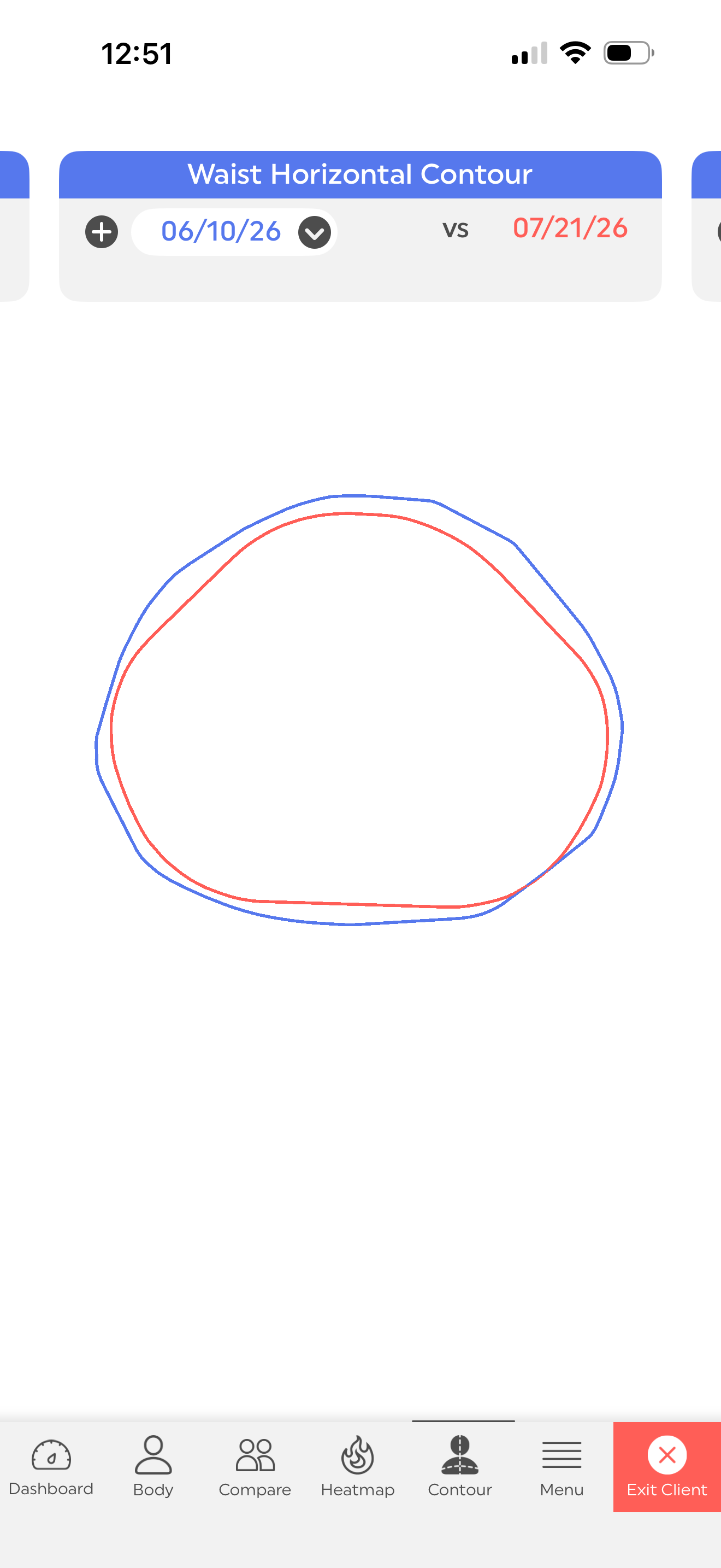 Waist circumference saw visible changes to the contouring of their shape. 