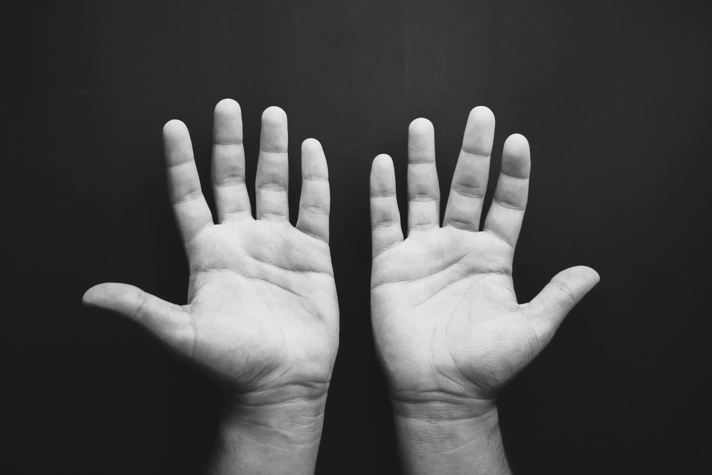 Photograph of two open hands, palms facing upward, showing the details of healthy human hands- and how unique we all are. The details of the skin texture exhibit the vulnerability of our hands, and that we need to care for and nourish them daily.