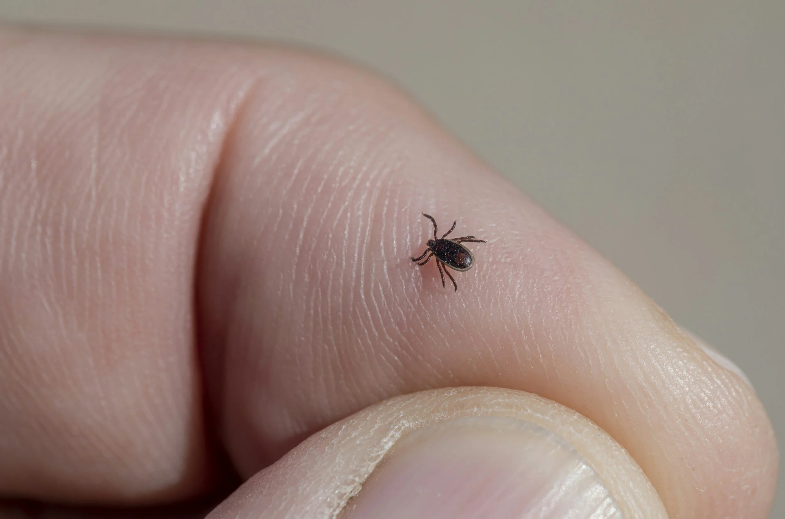Close-up of a human finger with a small tick attached to it.