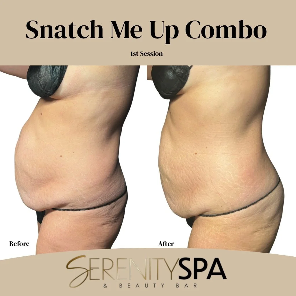 1 inch lost around the waist in just her first session!

Did you know that on average clients lose .5-2 inches per session with our noninvasive body contouring techniques? Yes, you read that correctly&hellip; PER SESSION &mdash; 100% NONINVASIVE!

We