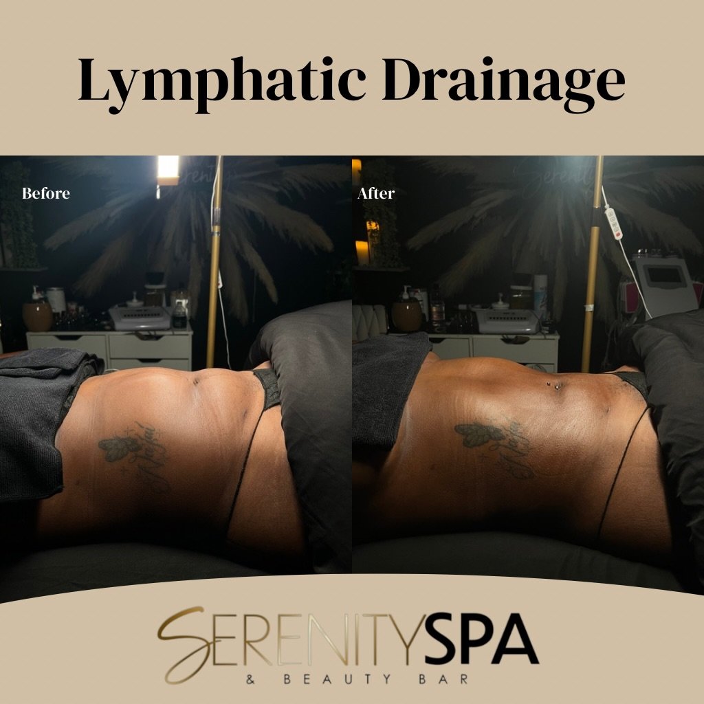 Post op Lymphatic Drainage Massage - 4 sessions in

Fibrosis removal done in the process

Serenityspaandbeautybarllc.com
