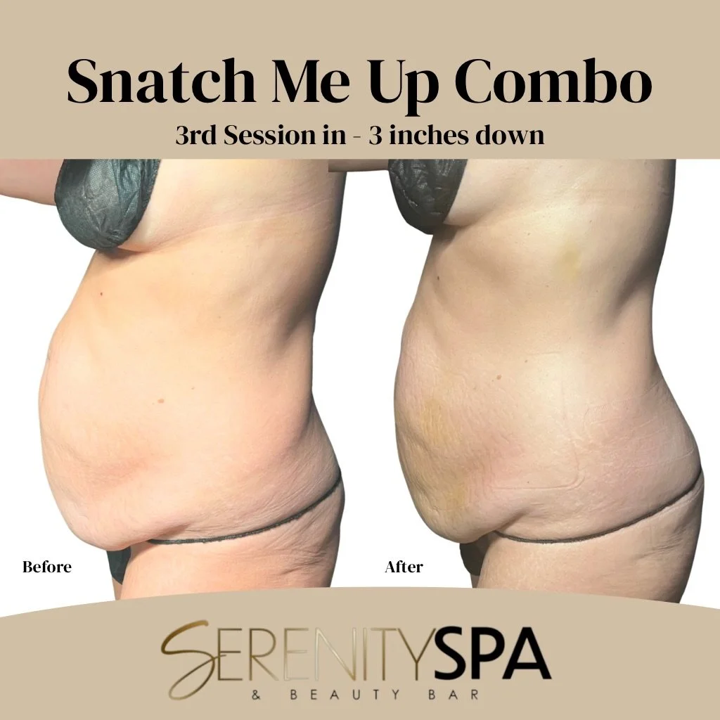 3 sessions in and 3 inches down 😍

Fully noninvasive body contouring, customized to your body&rsquo;s needs. 

This client has only been coming to us for 2 weeks! Let&rsquo;s lock you into your new body goals.

Book now on: 
Serenityspaandbeautybarl