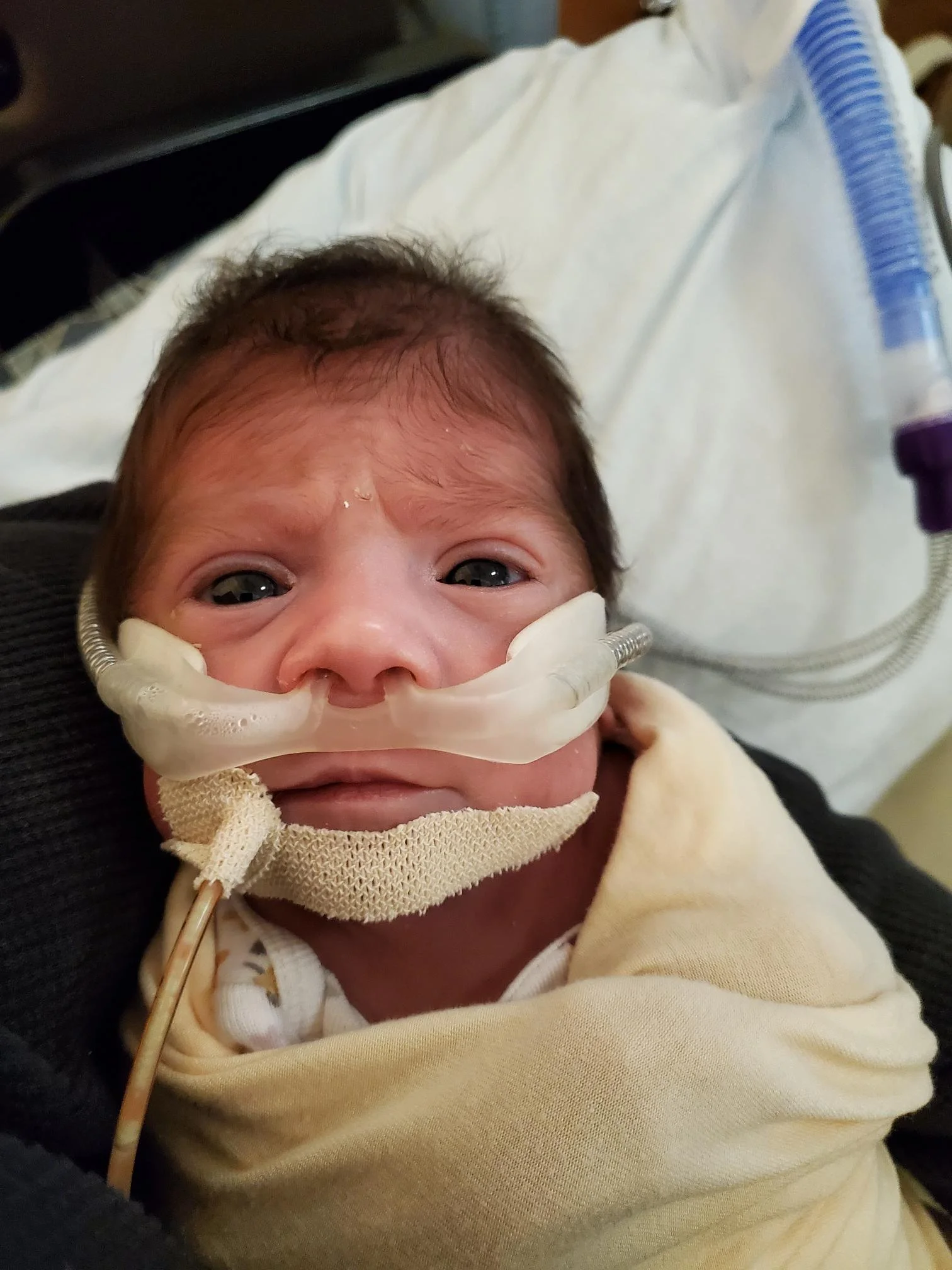 Close-up of a newborn baby with dark hair wearing a baby oxygen mask connected to a tube, lying on a hospital bed.