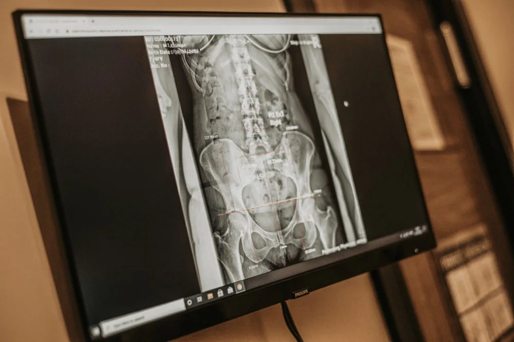 x-ray picture