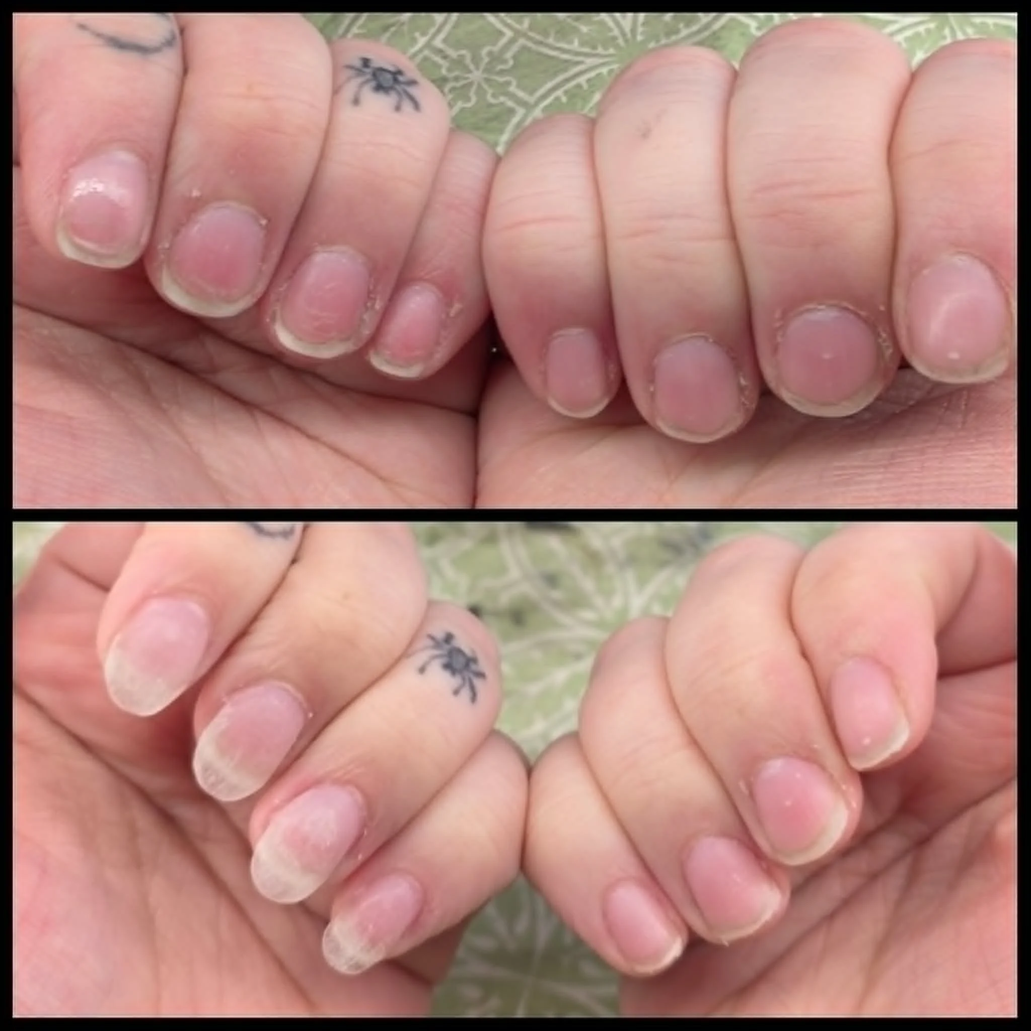 Close-up of two hands gripping each other, with visible tattoos of a small spider on one finger. The background shows a green, patterned surface.
